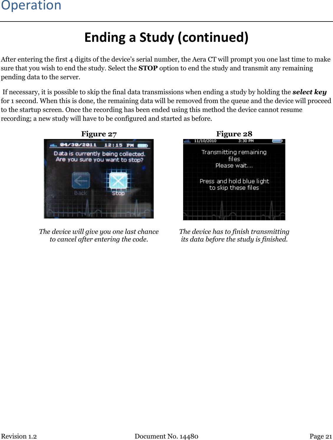 Revision 1.2 Document No. 14480 Page 21  Operation Ending a Study (continued) After entering the first 4 digits of the device’s serial number, the Aera CT will prompt you one last time to make sure that you wish to end the study. Select the STOP option to end the study and transmit any remaining pending data to the server.  If necessary, it is possible to skip the final data transmissions when ending a study by holding the select key for 1 second. When this is done, the remaining data will be removed from the queue and the device will proceed to the startup screen. Once the recording has been ended using this method the device cannot resume recording; a new study will have to be configured and started as before. Figure 27  Figure 28   The device will give you one last chance  to cancel after entering the code.  The device has to finish transmitting  its data before the study is finished.   