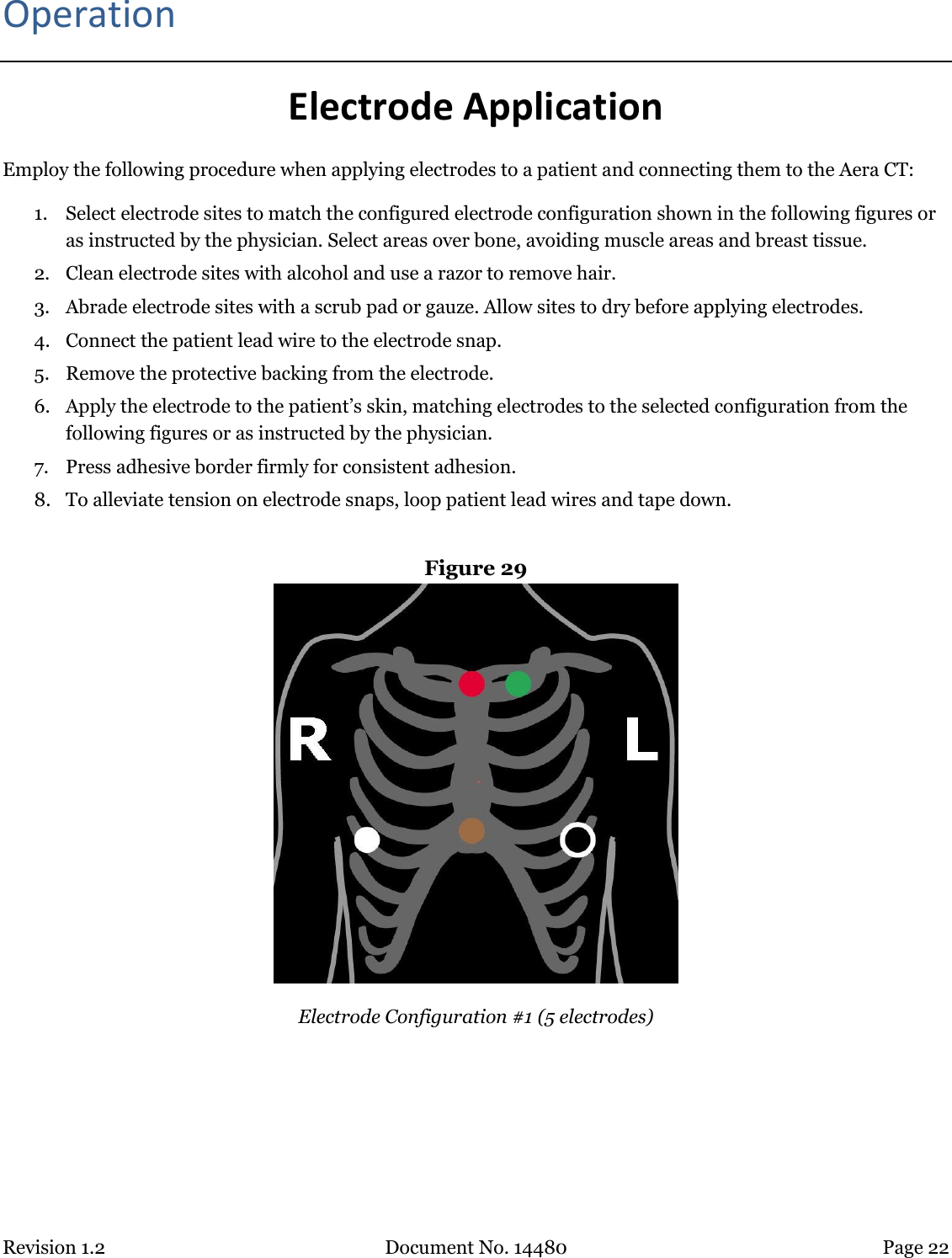 Revision 1.2 Document No. 14480 Page 22  Operation Electrode Application Employ the following procedure when applying electrodes to a patient and connecting them to the Aera CT: 1. Select electrode sites to match the configured electrode configuration shown in the following figures or as instructed by the physician. Select areas over bone, avoiding muscle areas and breast tissue. 2. Clean electrode sites with alcohol and use a razor to remove hair. 3. Abrade electrode sites with a scrub pad or gauze. Allow sites to dry before applying electrodes. 4. Connect the patient lead wire to the electrode snap. 5. Remove the protective backing from the electrode. 6. Apply the electrode to the patient’s skin, matching electrodes to the selected configuration from the following figures or as instructed by the physician. 7. Press adhesive border firmly for consistent adhesion. 8. To alleviate tension on electrode snaps, loop patient lead wires and tape down.  Figure 29   Electrode Configuration #1 (5 electrodes) 