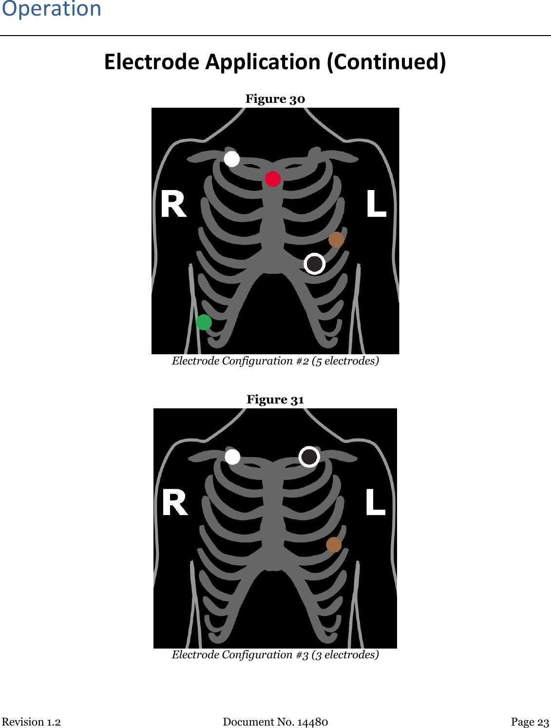 Revision 1.2 Document No. 14480 Page 23  Operation Electrode Application (Continued) Figure 30  Electrode Configuration #2 (5 electrodes)  Figure 31  Electrode Configuration #3 (3 electrodes) 