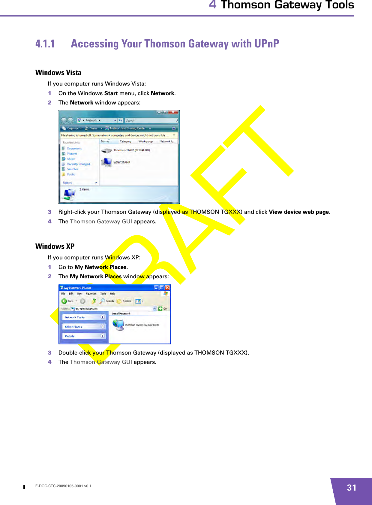 E-DOC-CTC-20090105-0001 v0.1 314 Thomson Gateway Tools4.1.1 Accessing Your Thomson Gateway with UPnPWindows VistaIf you computer runs Windows Vista:1On the Windows Start menu, click Network.2The Network window appears:3Right-click your Thomson Gateway (displayed as THOMSON TGXXX) and click View device web page.4The Thomson Gateway GUI appears.Windows XPIf you computer runs Windows XP:1Go to My Network Places.2The My Network Places window appears:3Double-click your Thomson Gateway (displayed as THOMSON TGXXX).4The Thomson Gateway GUI appears.