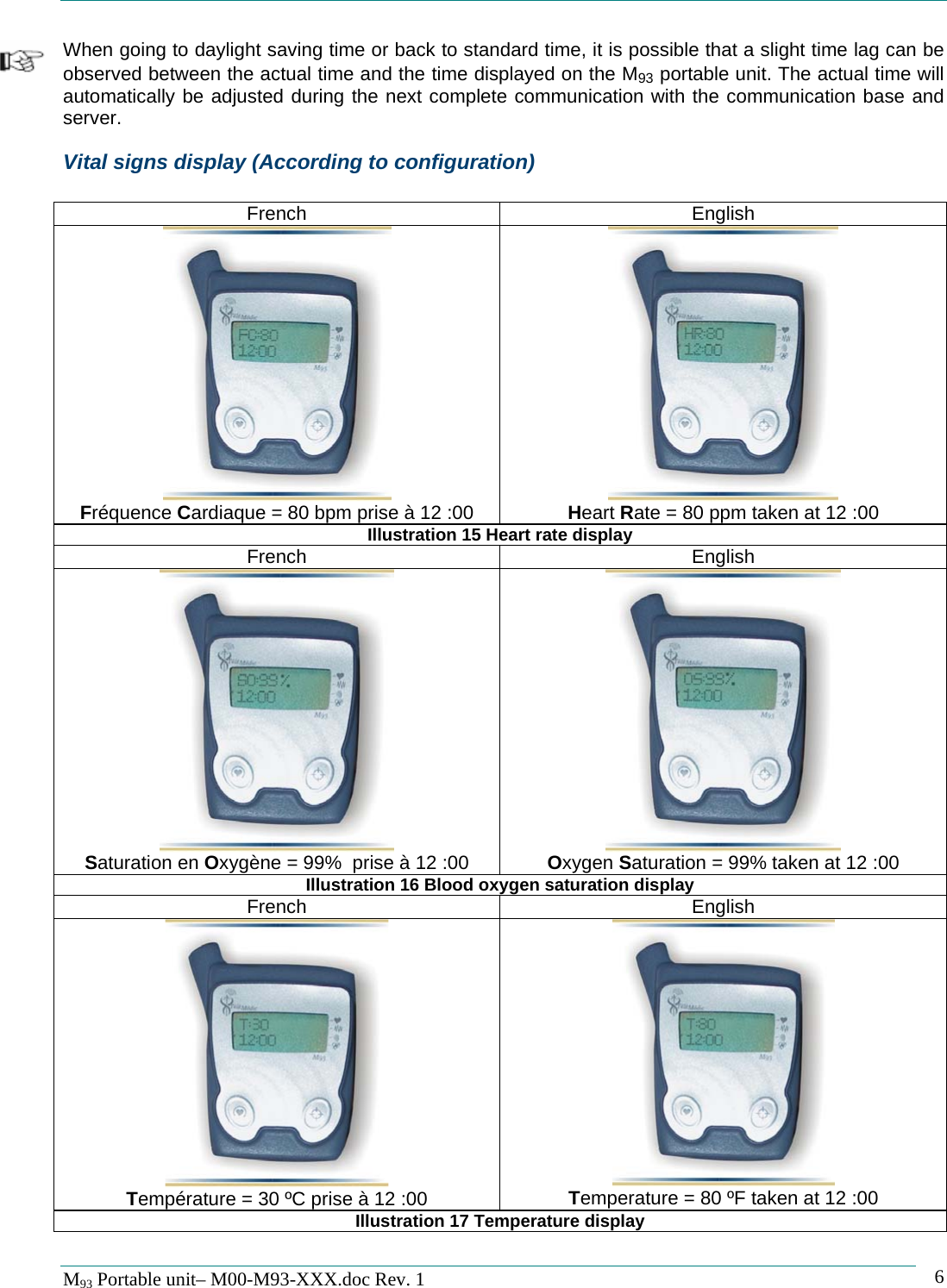   M93 Portable unit&ndash; M00-M93-XXX.doc Rev. 1    6When going to daylight saving time or back to standard time, it is possible that a slight time lag can be observed between the actual time and the time displayed on the M93 portable unit. The actual time will automatically be adjusted during the next complete communication with the communication base and server. Vital signs display (According to configuration)  French English  Fr&eacute;quence Cardiaque = 80 bpm prise &agrave; 12 :00   Heart Rate = 80 ppm taken at 12 :00 Illustration 15 Heart rate display French English  Saturation en Oxyg&egrave;ne = 99%  prise &agrave; 12 :00  Oxygen Saturation = 99% taken at 12 :00 Illustration 16 Blood oxygen saturation display French English  Temp&eacute;rature = 30 &ordm;C prise &agrave; 12 :00  Temperature = 80 &ordm;F taken at 12 :00  Illustration 17 Temperature display 