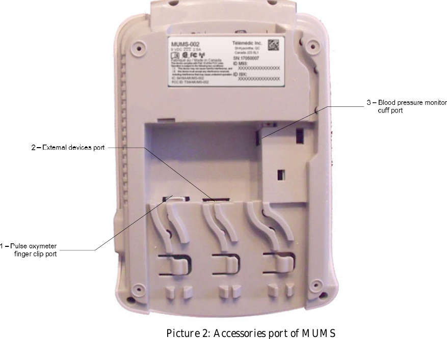   Picture 2: Accessories port of MUMS 