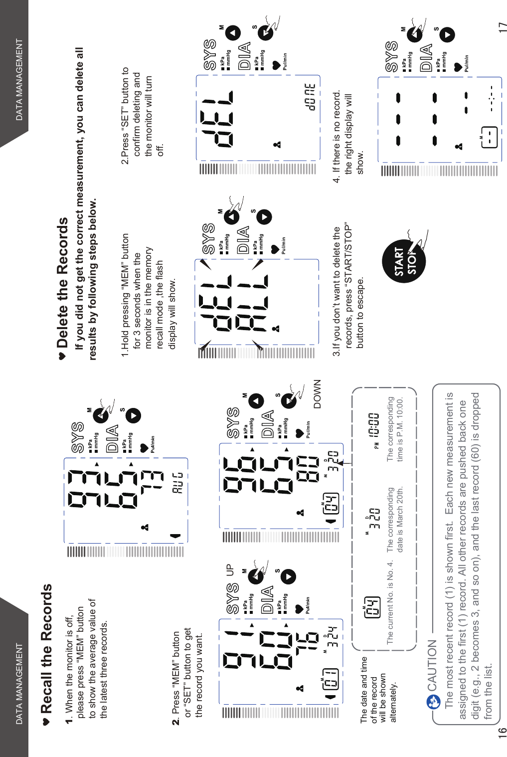 Recall the Records1. When the monitor is off, please press “MEM” buttonto show the average value of the latest three records.2. Press “MEM” buttonor “SET” button to getthe record you want.The most recent record (1) is shown first.  Each new measurement is assigned to the first (1) record. All other records are pushed back one digit (e.g., 2 becomes 3, and so on), and the last record (60) is dropped from the list.The current No. is No. 4. The corresponding time is P.M. 10:00.The corresponding date is March 20th.CAUTIONDOWNUPThe date and time of the record will be shown alternately.If you did not get the correct measurement, you can delete all results by following steps below.Delete the Records1.Hold pressing “MEM” button  for 3 seconds when themonitor is in the memory recall mode ,the flash display will show. 2.Press “SET” button to confirm deleting and the monitor will turn off.3.If you don’t want to delete the records, press “START/STOP” button to escape.4. If there is no record. the right display will show.STARTSTOPDATA MANAGEMENT DATA MANAGEMENT