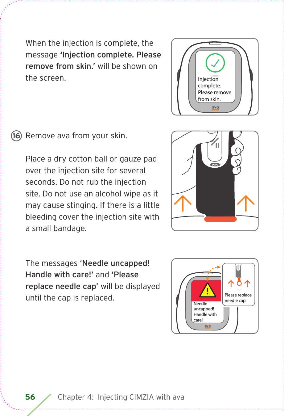 56 Chapter 4:  Injecting CIMZIA with avaWhen the injection is complete, the message ‘Injection complete. Please remove from skin.’ will be shown on the screen.Remove ava from your skin. Place a dry cotton ball or gauze pad over the injection site for several seconds. Do not rub the injection site. Do not use an alcohol wipe as it may cause stinging. If there is a little bleeding cover the injection site with a small bandage.The messages ‘Needle uncapped! Handle with care!’ and ‘Please replace needle cap’ will be displayed until the cap is replaced. Injection complete.Please removefrom skin.Press     to pause injection. 16!Needleuncapped!Handle with care!Please replaceneedle cap.