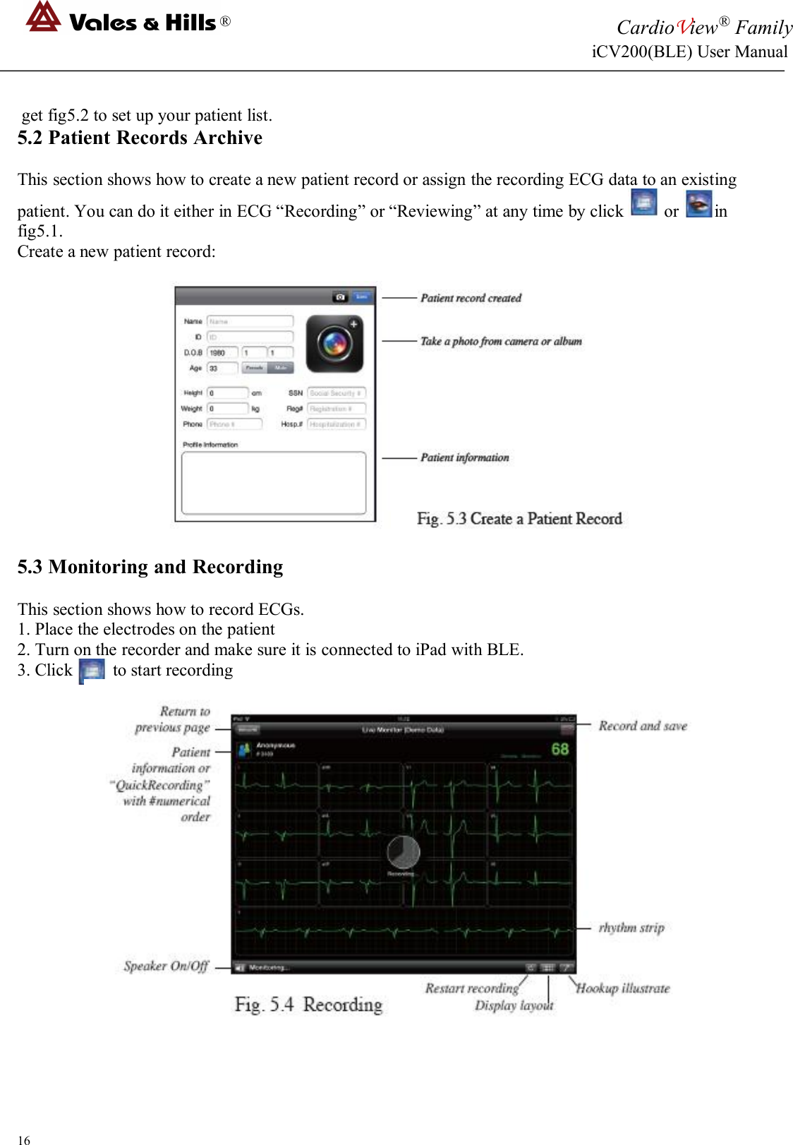 ®CardioView®FamilyiCV200(BLE) User Manual16get fig5.2 to set up your patient list.5.2 Patient Records ArchiveThis section shows how to create a new patient record or assign the recording ECG data to an existingpatient. You can do it either in ECG “Recording” or “Reviewing” at any time by click or infig5.1.Create a new patient record:5.3 Monitoring and RecordingThis section shows how to record ECGs.1. Place the electrodes on the patient2. Turn on the recorder and make sure it is connected to iPad with BLE.3. Click to start recording