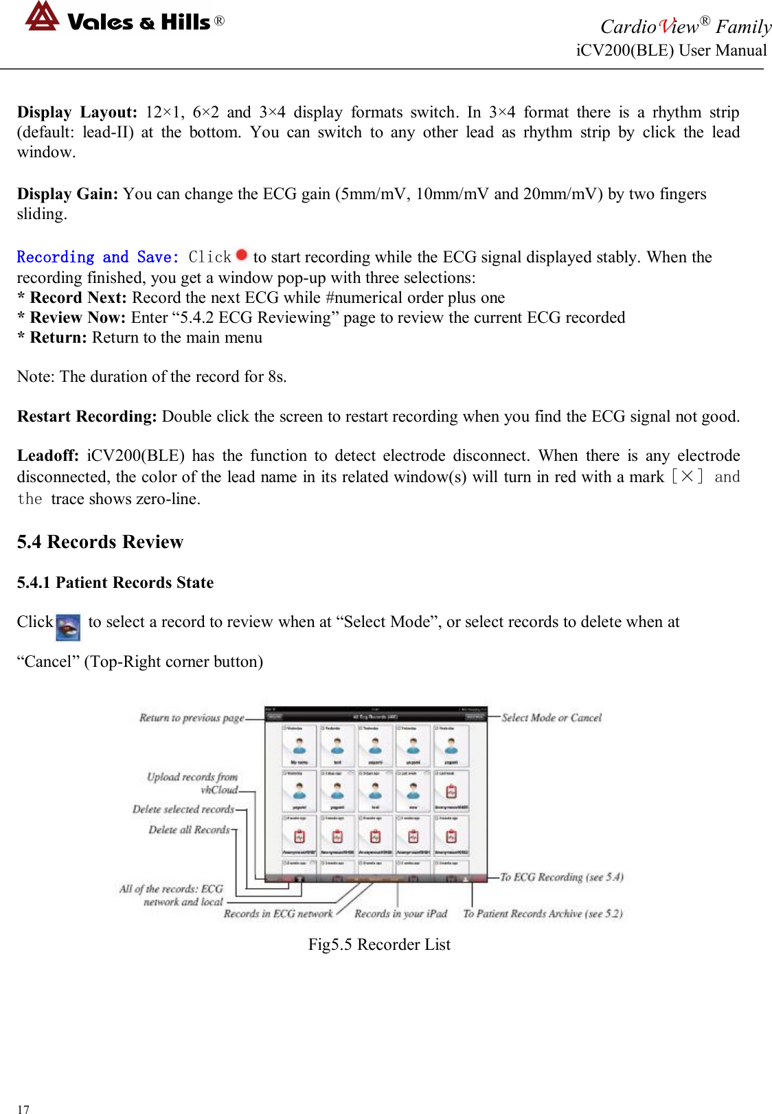 ®CardioView®FamilyiCV200(BLE) User Manual17Display Layout: 12×1, 6×2 and 3×4 display formats switch. In 3×4 format there is a rhythm strip(default: lead-II) at the bottom. You can switch to any other lead as rhythm strip by click the leadwindow.Display Gain: You can change the ECG gain (5mm/mV, 10mm/mV and 20mm/mV) by two fingerssliding.Recording and Save: Click to start recording while the ECG signal displayed stably. When therecording finished, you get a window pop-up with three selections:* Record Next: Record the next ECG while #numerical order plus one* Review Now: Enter “5.4.2 ECG Reviewing” page to review the current ECG recorded* Return: Return to the main menuNote: The duration of the record for 8s.Restart Recording: Double click the screen to restart recording when you find the ECG signal not good.Leadoff: iCV200(BLE) has the function to detect electrode disconnect. When there is any electrodedisconnected, the color of the lead name in its related window(s) will turn in red with a mark [×] andthe trace shows zero-line.5.4 Records Review5.4.1 Patient Records StateClick to select a record to review when at “Select Mode”, or select records to delete when at“Cancel” (Top-Right corner button)Fig5.5 Recorder List