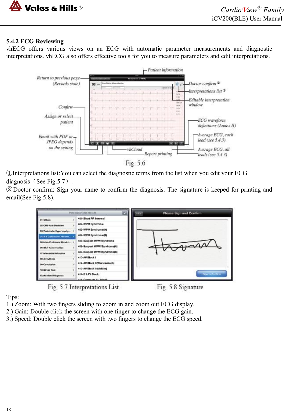 ®CardioView®FamilyiCV200(BLE) User Manual185.4.2 ECG ReviewingvhECG offers various views on an ECG with automatic parameter measurements and diagnosticinterpretations. vhECG also offers effective tools for you to measure parameters and edit interpretations.①Interpretations list:You can select the diagnostic terms from the list when you edit your ECGdiagnosis（See Fig.5.7）.②Doctor confirm: Sign your name to confirm the diagnosis. The signature is keeped for printing andemail(See Fig.5.8).Tips:1.) Zoom: With two fingers sliding to zoom in and zoom out ECG display.2.) Gain: Double click the screen with one finger to change the ECG gain.3.) Speed: Double click the screen with two fingers to change the ECG speed.