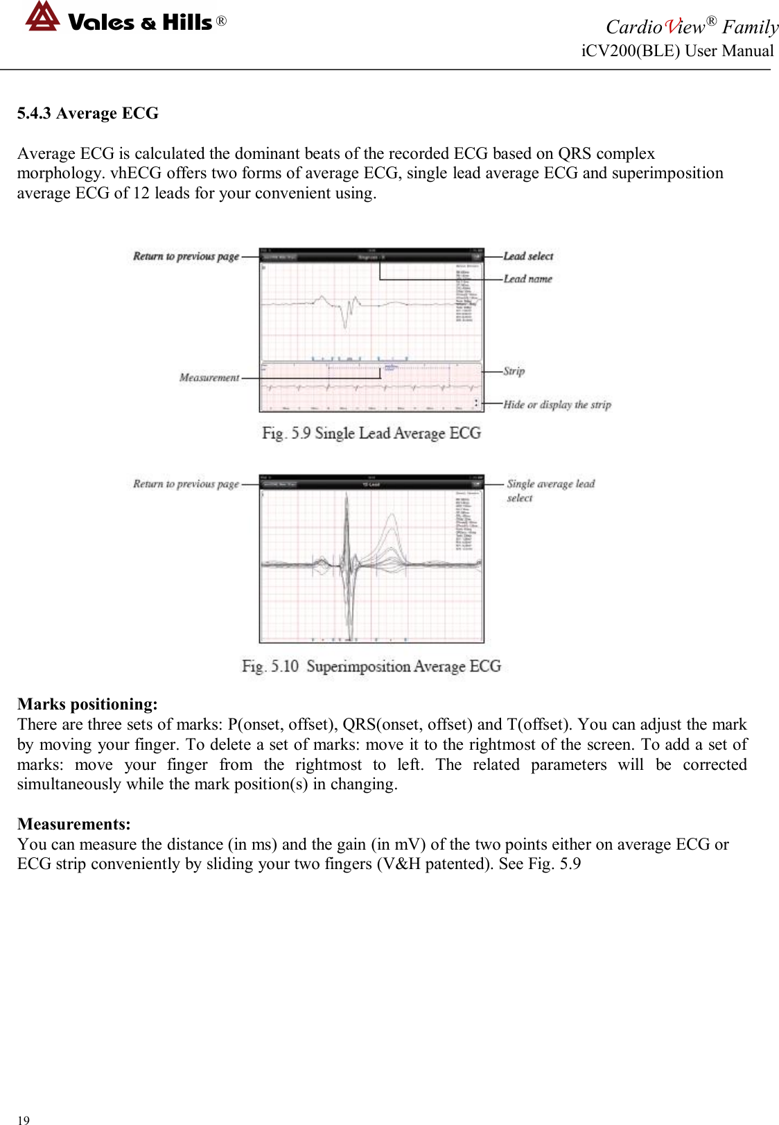 ®CardioView®FamilyiCV200(BLE) User Manual195.4.3 Average ECGAverage ECG is calculated the dominant beats of the recorded ECG based on QRS complexmorphology. vhECG offers two forms of average ECG, single lead average ECG and superimpositionaverage ECG of 12 leads for your convenient using.Marks positioning:There are three sets of marks: P(onset, offset), QRS(onset, offset) and T(offset). You can adjust the markby moving your finger. To delete a set of marks: move it to the rightmost of the screen. To add a set ofmarks: move your finger from the rightmost to left. The related parameters will be correctedsimultaneously while the mark position(s) in changing.Measurements:You can measure the distance (in ms) and the gain (in mV) of the two points either on average ECG orECG strip conveniently by sliding your two fingers (V&amp;H patented). See Fig. 5.9