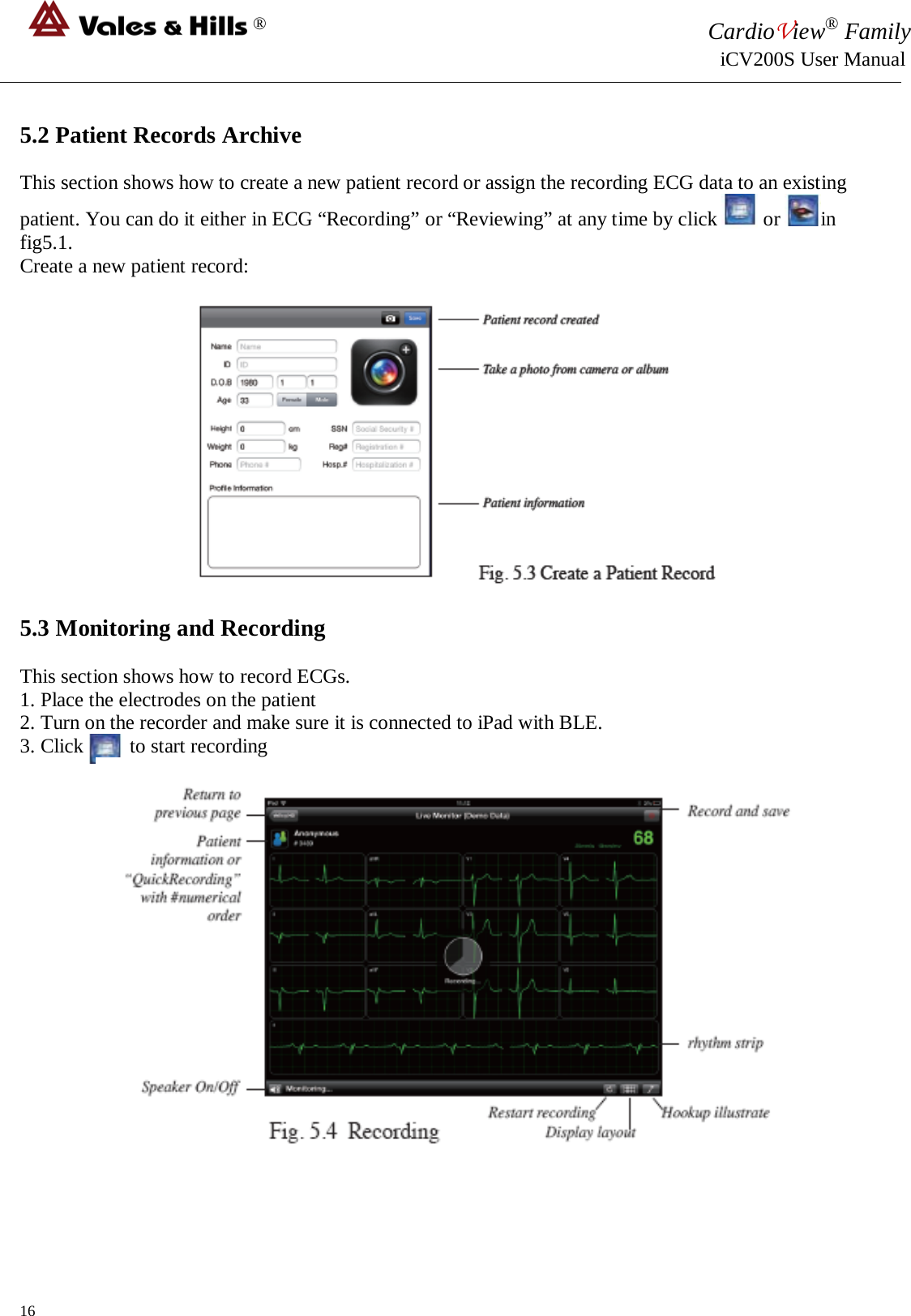 ® CardioView® Family                                                                                                     iCV200S User Manual  5.2 Patient Records Archive  This section shows how to create a new patient record or assign the recording ECG data to an existing patient. You can do it either in ECG “Recording” or “Reviewing” at any time by click         or  in fig5.1. Create a new patient record:    5.3 Monitoring and Recording  This section shows how to record ECGs. 1. Place the electrodes on the patient 2. Turn on the recorder and make sure it is connected to iPad with BLE. 3. Click         to start recording   16 