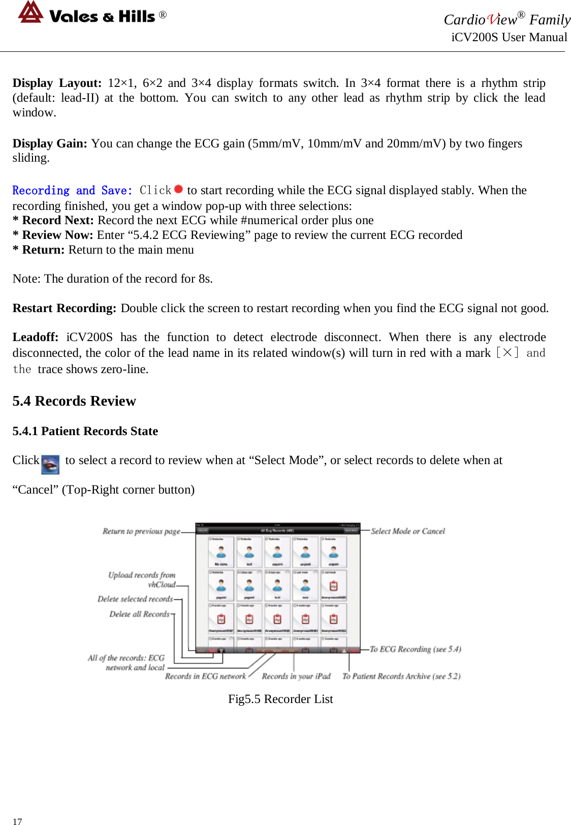 ® CardioView® Family                                                                                                     iCV200S User Manual  Display  Layout:  12×1,  6×2 and 3×4 display formats switch.  In  3×4  format there is a rhythm strip (default: lead-II) at the bottom. You can switch to any other  lead as rhythm strip by click the lead window.    Display Gain: You can change the ECG gain (5mm/mV, 10mm/mV and 20mm/mV) by two fingers sliding.  Recording and Save: Click   to start recording while the ECG signal displayed stably. When the recording finished, you get a window pop-up with three selections: * Record Next: Record the next ECG while #numerical order plus one * Review Now: Enter “5.4.2 ECG Reviewing” page to review the current ECG recorded * Return: Return to the main menu  Note: The duration of the record for 8s.  Restart Recording: Double click the screen to restart recording when you find the ECG signal not good.  Leadoff:  iCV200S  has the function to detect electrode disconnect. When there is any electrode disconnected, the color of the lead name in its related window(s) will turn in red with a mark [×] and the trace shows zero-line.  5.4 Records Review  5.4.1 Patient Records State  Click        to select a record to review when at “Select Mode”, or select records to delete when at   “Cancel” (Top-Right corner button)    Fig5.5 Recorder List     17 