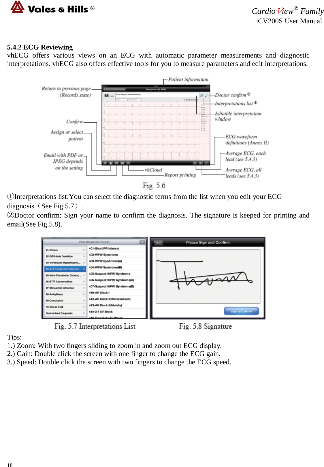 ® CardioView® Family                                                                                                     iCV200S User Manual  5.4.2 ECG Reviewing vhECG offers various views on an ECG with automatic parameter measurements and diagnostic interpretations. vhECG also offers effective tools for you to measure parameters and edit interpretations.   ①Interpretations list:You can select the diagnostic terms from the list when you edit your ECG diagnosis（See Fig.5.7）. ②Doctor confirm: Sign your name to confirm the diagnosis. The signature is keeped for printing and email(See Fig.5.8).  Tips: 1.) Zoom: With two fingers sliding to zoom in and zoom out ECG display. 2.) Gain: Double click the screen with one finger to change the ECG gain. 3.) Speed: Double click the screen with two fingers to change the ECG speed.         18 