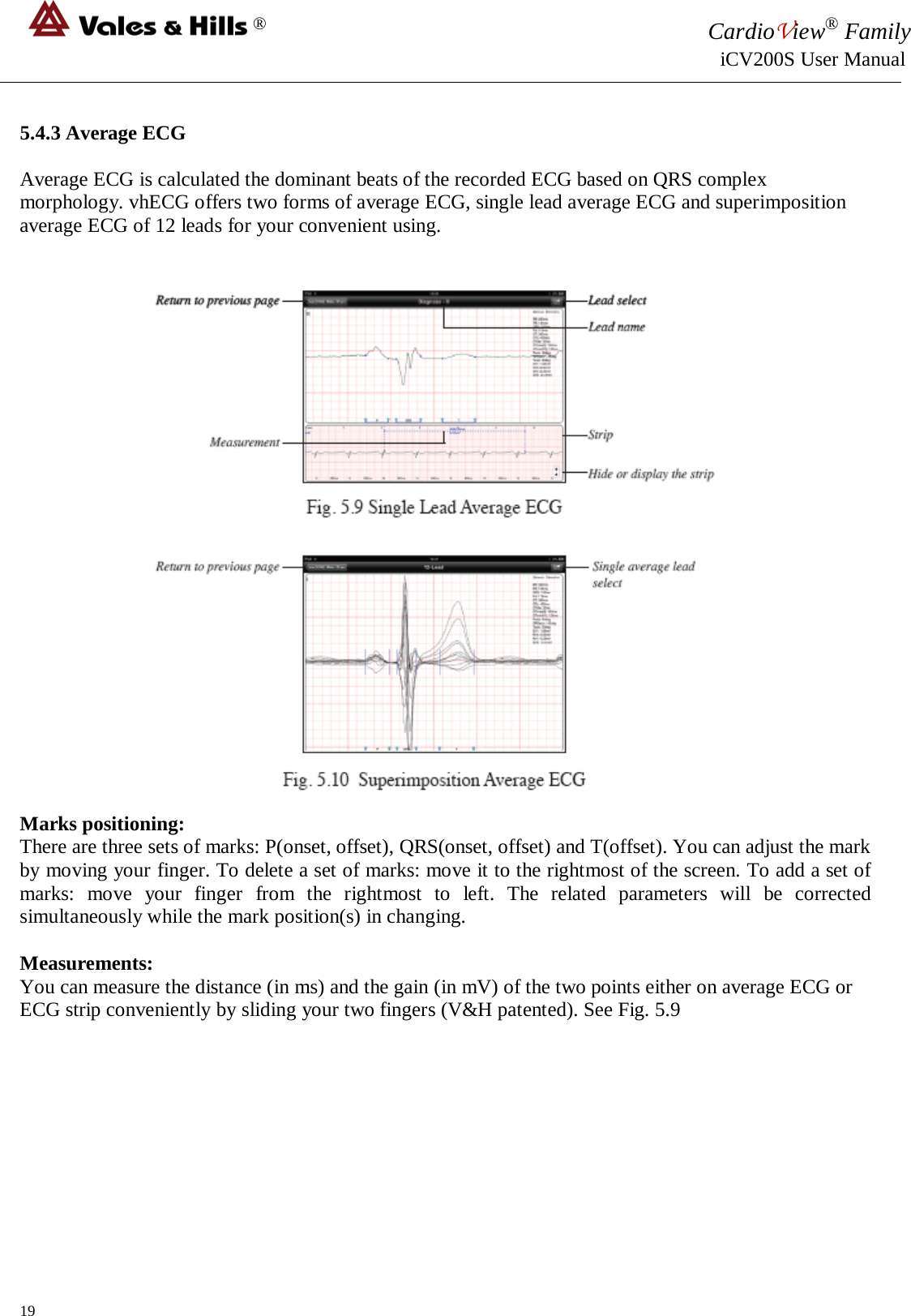 ® CardioView® Family                                                                                                     iCV200S User Manual  5.4.3 Average ECG  Average ECG is calculated the dominant beats of the recorded ECG based on QRS complex morphology. vhECG offers two forms of average ECG, single lead average ECG and superimposition average ECG of 12 leads for your convenient using.   Marks positioning: There are three sets of marks: P(onset, offset), QRS(onset, offset) and T(offset). You can adjust the mark by moving your finger. To delete a set of marks: move it to the rightmost of the screen. To add a set of marks: move your finger from the rightmost to left. The related parameters will be corrected simultaneously while the mark position(s) in changing.  Measurements: You can measure the distance (in ms) and the gain (in mV) of the two points either on average ECG or ECG strip conveniently by sliding your two fingers (V&amp;H patented). See Fig. 5.9          19 