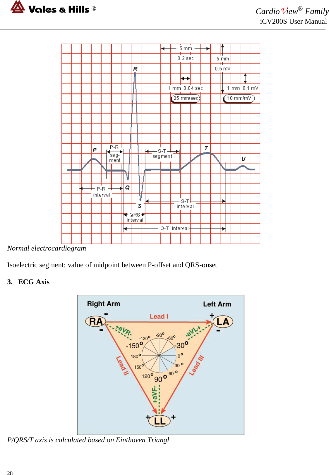 ® CardioView® Family                                                                                                     iCV200S User Manual   Normal electrocardiogram  Isoelectric segment: value of midpoint between P-offset and QRS-onset  3. ECG Axis   P/QRS/T axis is calculated based on Einthoven Triangl 28 