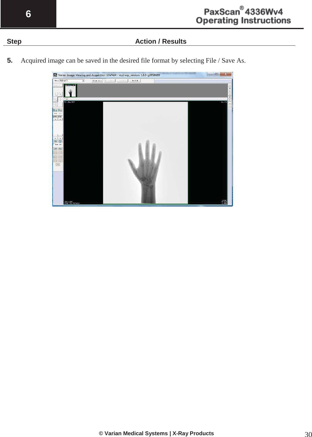  6   © Varian Medical Systems | X-Ray Products 30 Step Action / Results  5.   Acquired image can be saved in the desired file format by selecting File / Save As.          