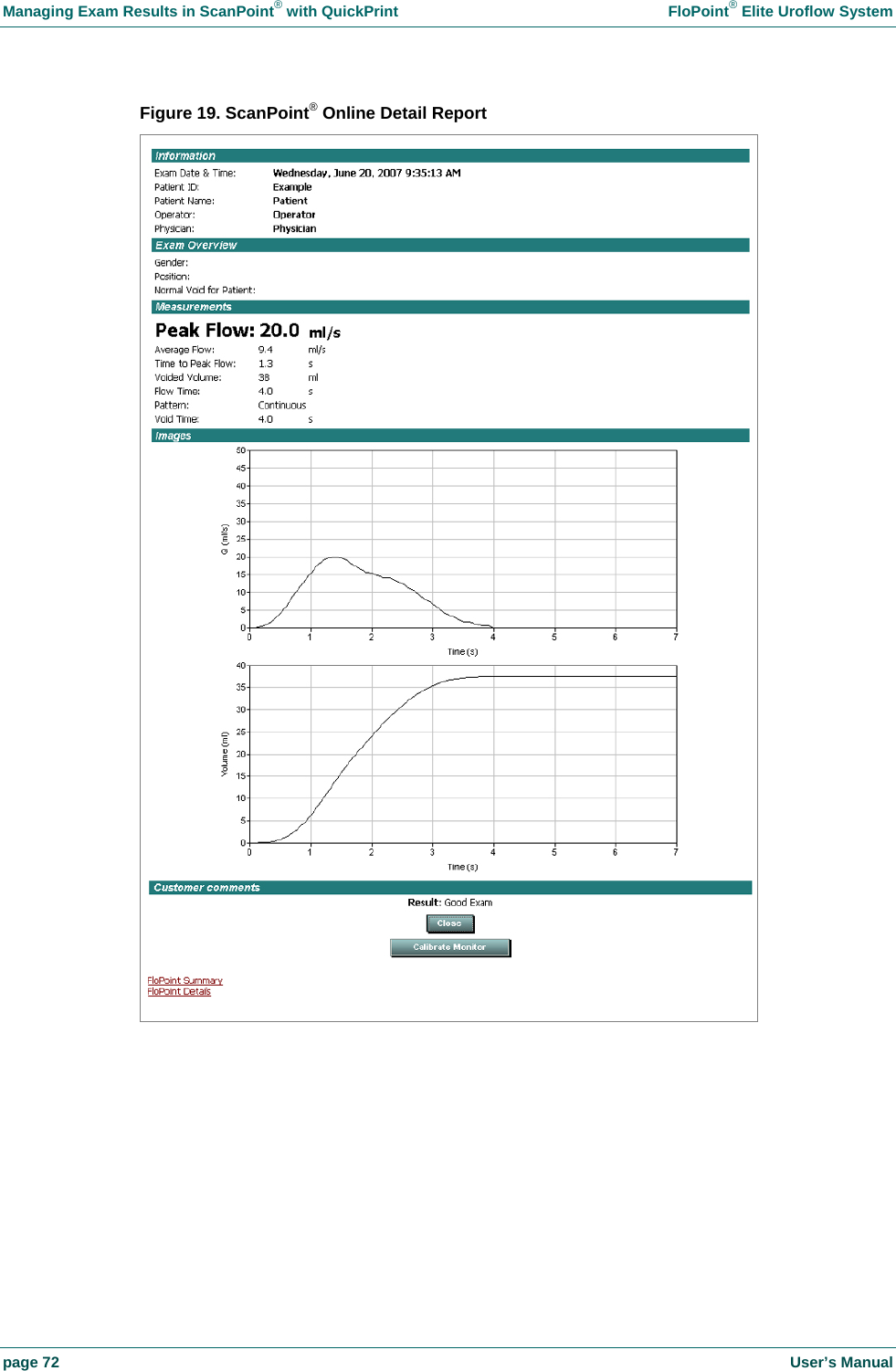 Managing Exam Results in ScanPoint&reg; with QuickPrint    FloPoint&reg; Elite Uroflow System page 72    User&rsquo;s Manual Figure 19. ScanPoint&reg; Online Detail Report    