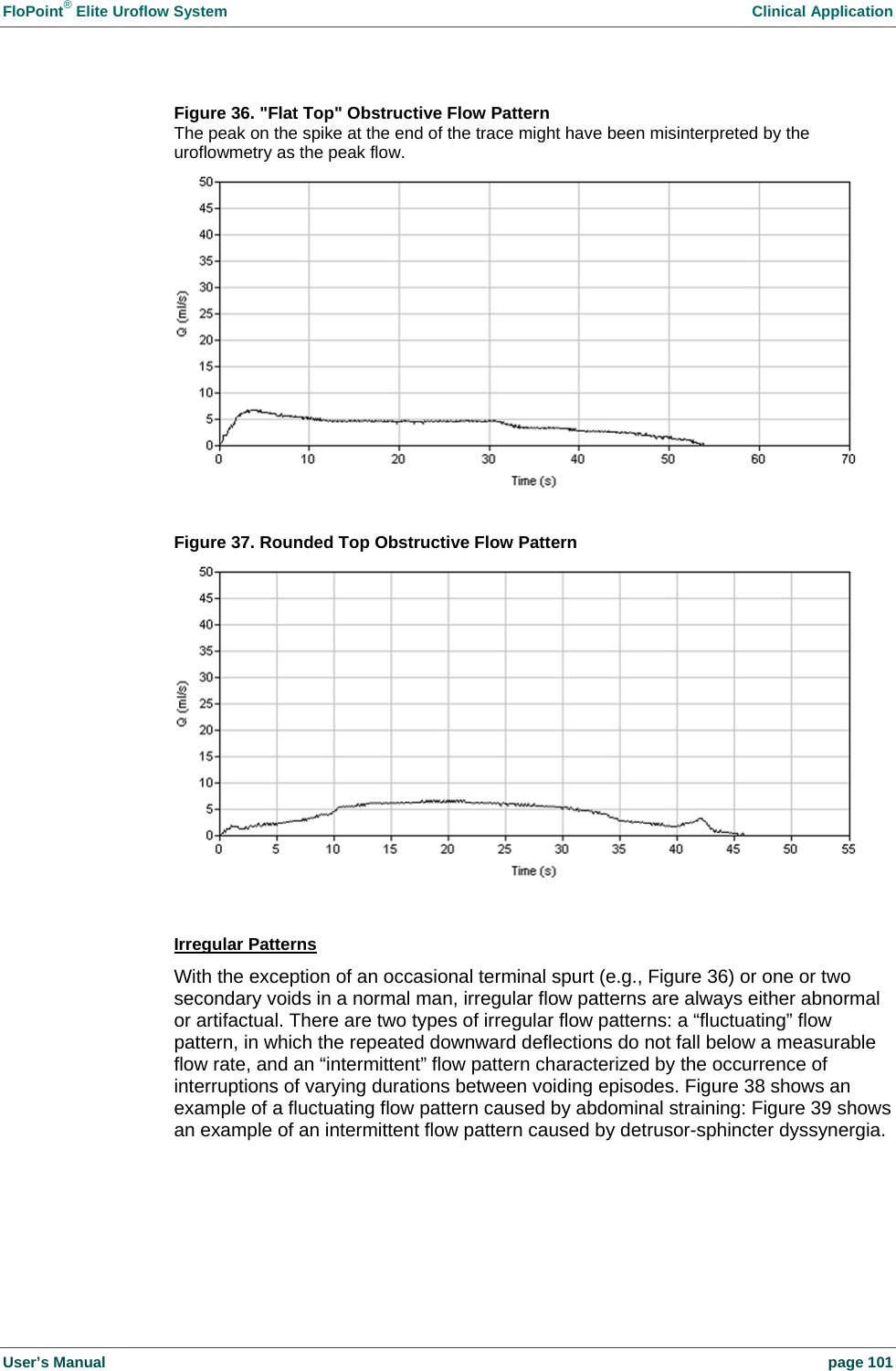 FloPoint&reg; Elite Uroflow System    Clinical Application User&rsquo;s Manual    page 101 Figure 36. "Flat Top" Obstructive Flow Pattern The peak on the spike at the end of the trace might have been misinterpreted by the uroflowmetry as the peak flow.   Figure 37. Rounded Top Obstructive Flow Pattern   Irregular Patterns With the exception of an occasional terminal spurt (e.g., Figure 36) or one or two secondary voids in a normal man, irregular flow patterns are always either abnormal or artifactual. There are two types of irregular flow patterns: a &ldquo;fluctuating&rdquo; flow pattern, in which the repeated downward deflections do not fall below a measurable flow rate, and an &ldquo;intermittent&rdquo; flow pattern characterized by the occurrence of interruptions of varying durations between voiding episodes. Figure 38 shows an example of a fluctuating flow pattern caused by abdominal straining: Figure 39 shows an example of an intermittent flow pattern caused by detrusor-sphincter dyssynergia.  