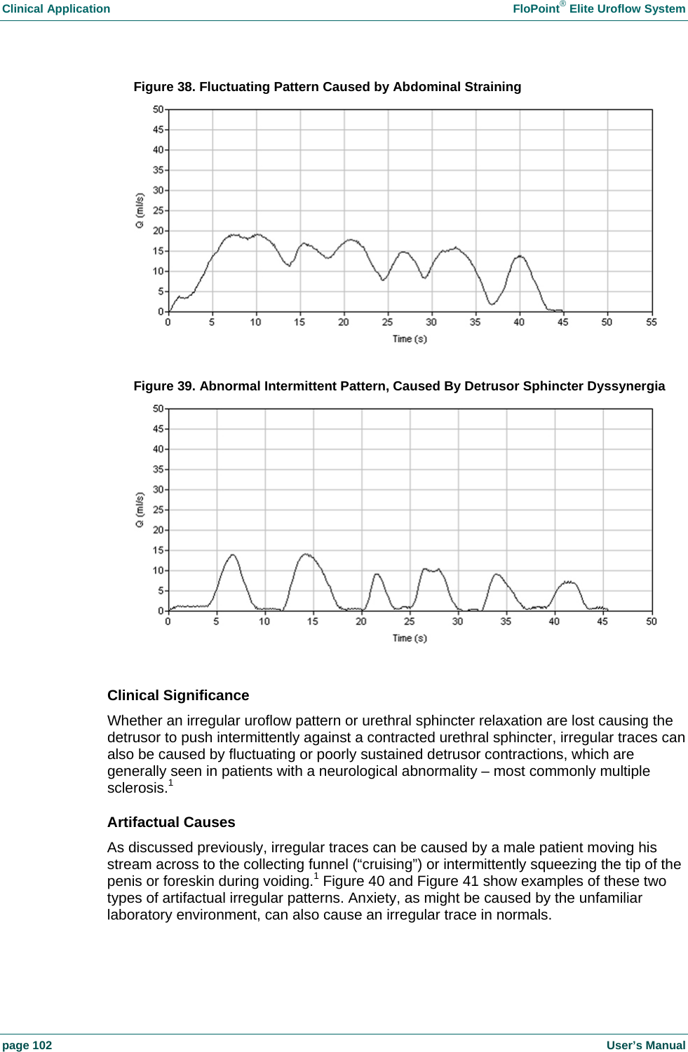 Clinical Application    FloPoint&reg; Elite Uroflow System page 102    User&rsquo;s Manual Figure 38. Fluctuating Pattern Caused by Abdominal Straining   Figure 39. Abnormal Intermittent Pattern, Caused By Detrusor Sphincter Dyssynergia   Clinical Significance Whether an irregular uroflow pattern or urethral sphincter relaxation are lost causing the detrusor to push intermittently against a contracted urethral sphincter, irregular traces can also be caused by fluctuating or poorly sustained detrusor contractions, which are generally seen in patients with a neurological abnormality &ndash; most commonly multiple sclerosis.1  Artifactual Causes As discussed previously, irregular traces can be caused by a male patient moving his stream across to the collecting funnel (&ldquo;cruising&rdquo;) or intermittently squeezing the tip of the penis or foreskin during voiding.1 Figure 40 and Figure 41 show examples of these two types of artifactual irregular patterns. Anxiety, as might be caused by the unfamiliar laboratory environment, can also cause an irregular trace in normals.  