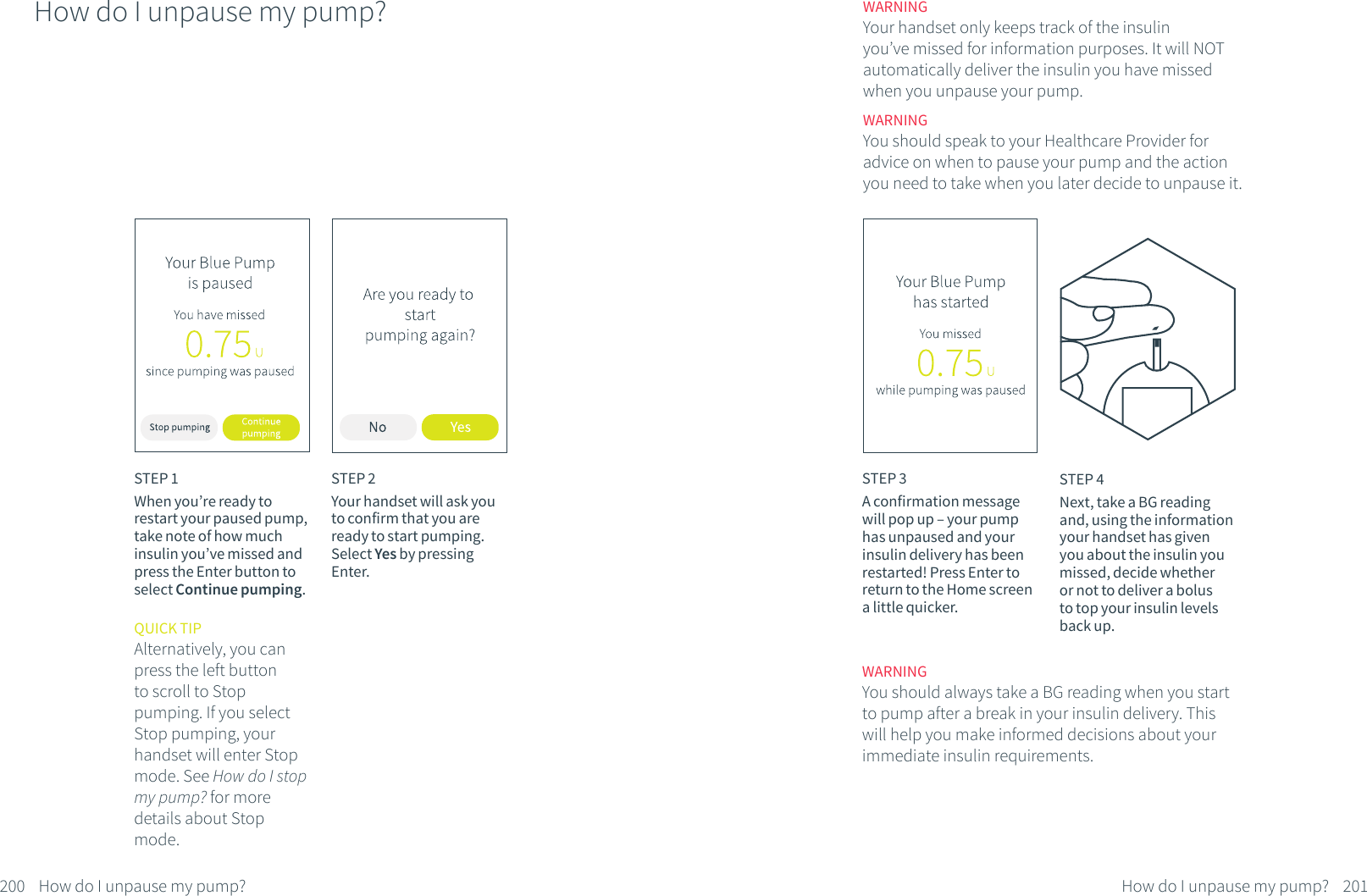 How do I unpause my pump?STEP 1When you&rsquo;re ready to restart your paused pump, take note of how much insulin you&rsquo;ve missed and press the Enter button to select Continue pumping.QUICK TIPAlternatively, you can press the left buttonto scroll to Stop pumping. If you select Stop pumping, your handset will enter Stop mode. See How do I stop my pump? for more details about Stop mode.STEP 2Your handset will ask you to confirm that you are ready to start pumping. Select Yes by pressing Enter.200 How do I unpause my pump?STEP 3A confirmation message will pop up &ndash; your pump has unpaused and your insulin delivery has been restarted! Press Enter to return to the Home screen a little quicker.WARNINGYour handset only keeps track of the insulin you&rsquo;ve missed for information purposes. It will NOT automatically deliver the insulin you have missed when you unpause your pump.WARNINGYou should speak to your Healthcare Provider for advice on when to pause your pump and the action you need to take when you later decide to unpause it.WARNINGYou should always take a BG reading when you start to pump after a break in your insulin delivery. This will help you make informed decisions about your immediate insulin requirements. 201How do I unpause my pump?STEP 4Next, take a BG reading and, using the information your handset has given you about the insulin you missed, decide whether or not to deliver a bolus to top your insulin levels back up.