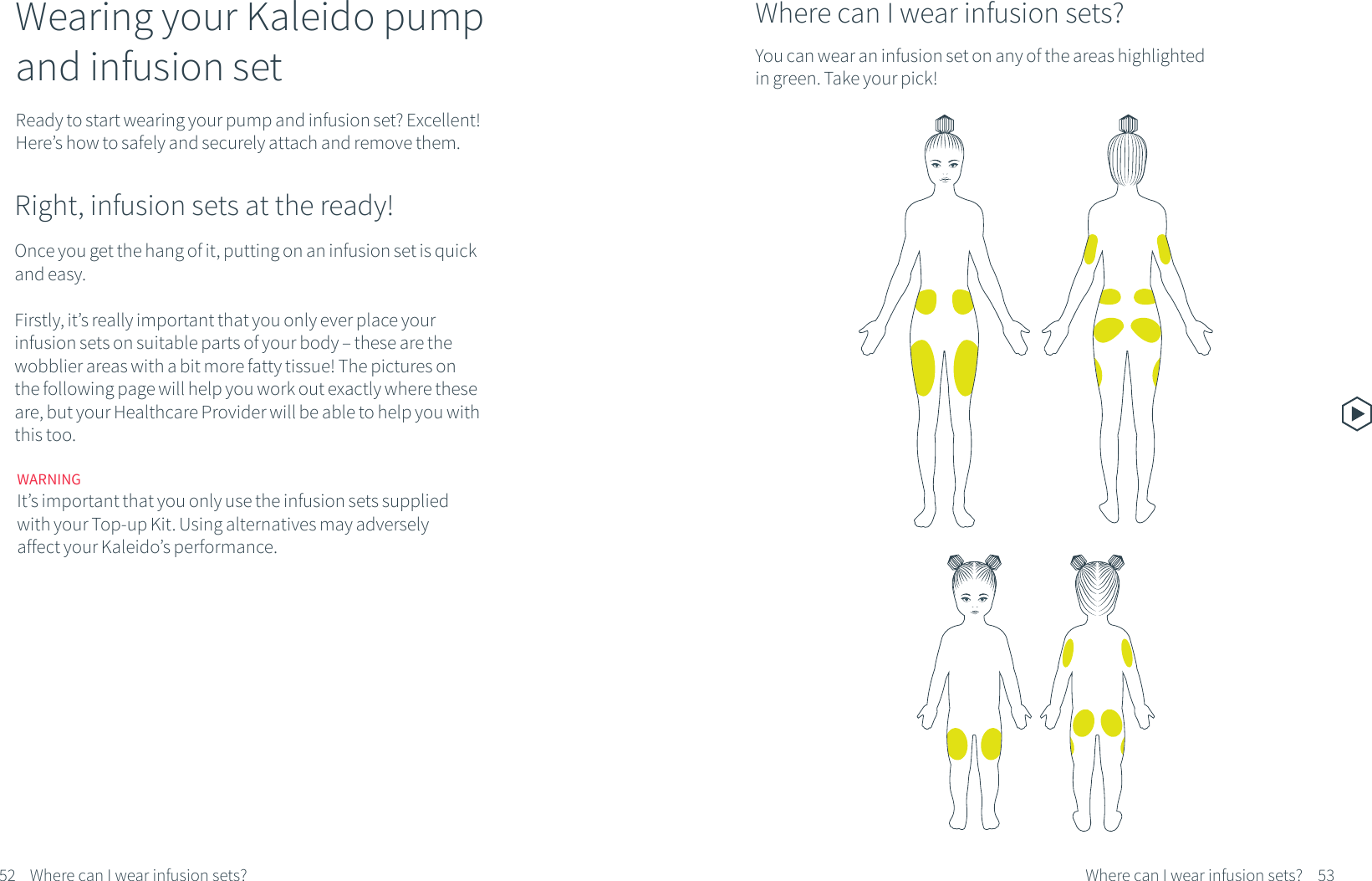 WARNINGIt&rsquo;s important that you only use the infusion sets supplied with your Top-up Kit. Using alternatives may adversely affect your Kaleido&rsquo;s performance.Right, infusion sets at the ready!Ready to start wearing your pump and infusion set? Excellent! Here&rsquo;s how to safely and securely attach and remove them.Once you get the hang of it, putting on an infusion set is quick and easy. Firstly, it&rsquo;s really important that you only ever place your infusion sets on suitable parts of your body &ndash; these are the wobblier areas with a bit more fatty tissue! The pictures on the following page will help you work out exactly where these are, but your Healthcare Provider will be able to help you with this too. Wearing your Kaleido pumpand infusion set52 53Where can I wear infusion sets?Where can I wear infusion sets?Where can I wear infusion sets?You can wear an infusion set on any of the areas highlighted in green. Take your pick!