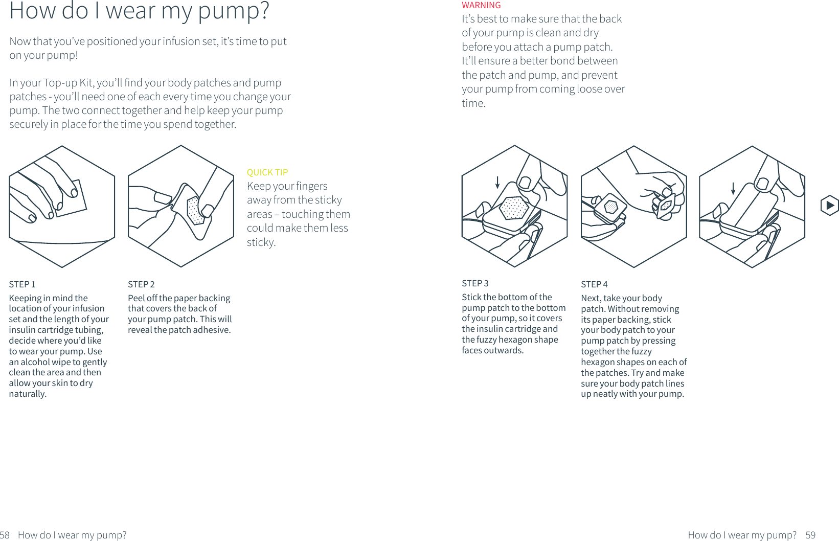 WARNINGIt&rsquo;s best to make sure that the back of your pump is clean and dry before you attach a pump patch. It&rsquo;ll ensure a better bond between the patch and pump, and prevent your pump from coming loose over time.STEP 2Peel off the paper backing that covers the back of your pump patch. This will reveal the patch adhesive. QUICK TIPKeep your fingers away from the sticky areas &ndash; touching them could make them less sticky.STEP 4Next, take your body patch. Without removing its paper backing, stick your body patch to your pump patch by pressing together the fuzzy hexagon shapes on each of the patches. Try and make sure your body patch lines up neatly with your pump. 58 59How do I wear my pump?How do I wear my pump?STEP 1Keeping in mind the location of your infusion set and the length of your insulin cartridge tubing, decide where you&rsquo;d like to wear your pump. Use an alcohol wipe to gently clean the area and then allow your skin to dry naturally.How do I wear my pump?Now that you&rsquo;ve positioned your infusion set, it&rsquo;s time to put on your pump! In your Top-up Kit, you&rsquo;ll find your body patches and pump patches - you&rsquo;ll need one of each every time you change your pump. The two connect together and help keep your pump securely in place for the time you spend together.STEP 3Stick the bottom of the pump patch to the bottom of your pump, so it covers the insulin cartridge and the fuzzy hexagon shape faces outwards. 