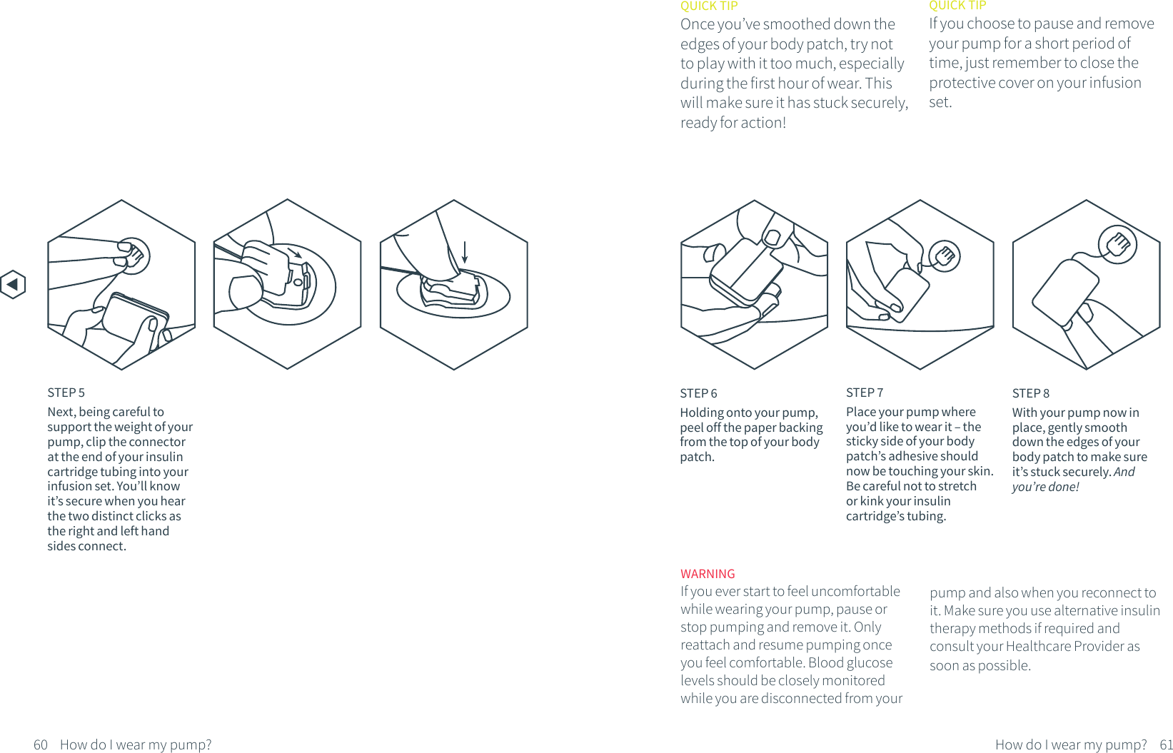 STEP 5Next, being careful to support the weight of your pump, clip the connector at the end of your insulin cartridge tubing into your infusion set. You&rsquo;ll know it&rsquo;s secure when you hear the two distinct clicks as the right and left hand sides connect.STEP 6Holding onto your pump, peel off the paper backing from the top of your body patch.STEP 7Place your pump where you&rsquo;d like to wear it &ndash; the sticky side of your body patch&rsquo;s adhesive should now be touching your skin. Be careful not to stretch or kink your insulin cartridge&rsquo;s tubing.STEP 8With your pump now in place, gently smooth down the edges of your body patch to make sure it&rsquo;s stuck securely. And you&rsquo;re done!WARNINGIf you ever start to feel uncomfortable while wearing your pump, pause or stop pumping and remove it. Only reattach and resume pumping once you feel comfortable. Blood glucose levels should be closely monitored while you are disconnected from your QUICK TIPIf you choose to pause and remove your pump for a short period of time, just remember to close the protective cover on your infusion set.QUICK TIPOnce you&rsquo;ve smoothed down the edges of your body patch, try not to play with it too much, especially during the first hour of wear. This will make sure it has stuck securely, ready for action!60 61How do I wear my pump?How do I wear my pump?pump and also when you reconnect to it. Make sure you use alternative insulin therapy methods if required and consult your Healthcare Provider as soon as possible. 