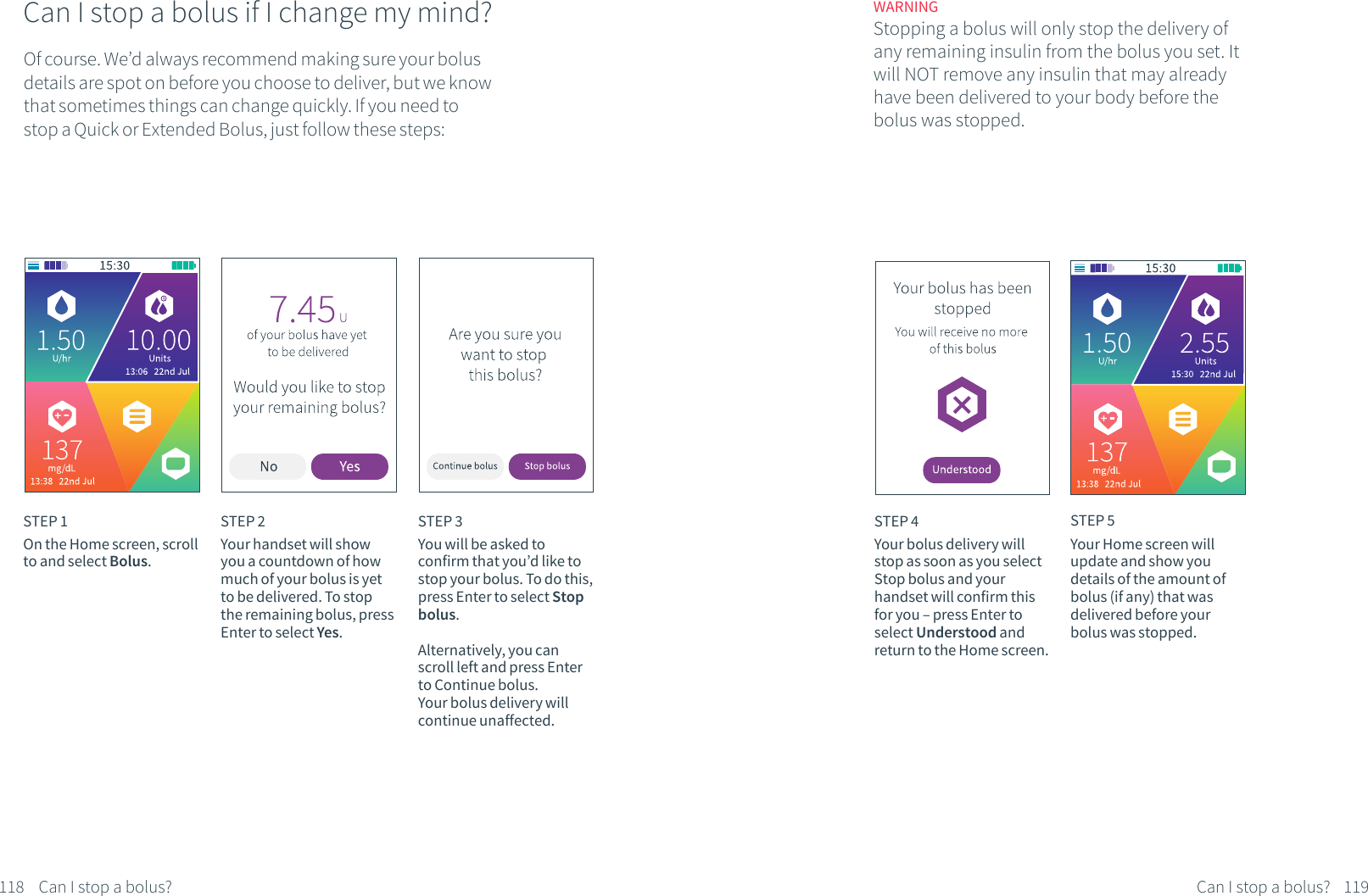 Can I stop a bolus if I change my mind?Of course. We&rsquo;d always recommend making sure your bolus details are spot on before you choose to deliver, but we know that sometimes things can change quickly. If you need to stop a Quick or Extended Bolus, just follow these steps:STEP 1On the Home screen, scroll to and select Bolus.STEP 2Your handset will show you a countdown of how much of your bolus is yet to be delivered. To stop the remaining bolus, press Enter to select Yes.STEP 3You will be asked to confirm that you&rsquo;d like to stop your bolus. To do this, press Enter to select Stop bolus. Alternatively, you can scroll left and press Enter to Continue bolus. Your bolus delivery will continue unaffected.STEP 4Your bolus delivery will stop as soon as you select Stop bolus and your handset will confirm this for you &ndash; press Enter to select Understood and return to the Home screen. STEP 5Your Home screen will update and show you details of the amount of bolus (if any) that was delivered before your bolus was stopped.WARNINGStopping a bolus will only stop the delivery of any remaining insulin from the bolus you set. It will NOT remove any insulin that may already have been delivered to your body before the bolus was stopped.Can I stop a bolus? Can I stop a bolus?118 119