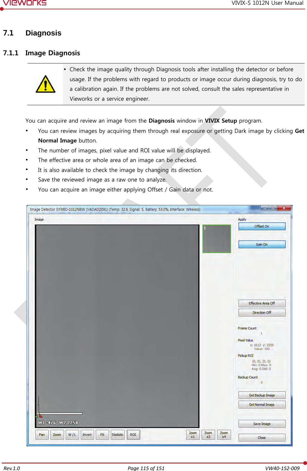   Rev.1.0 Page 115 of 151  VW40-152-009 VIVIX-S 1012N User Manual 7.1 Diagnosis 7.1.1 Image Diagnosis   Check the image quality through Diagnosis tools after installing the detector or before usage. If the problems with regard to products or image occur during diagnosis, try to do a calibration again. If the problems are not solved, consult the sales representative in Vieworks or a service engineer.  You can acquire and review an image from the Diagnosis window in VIVIX Setup program.  You can review images by acquiring them through real exposure or getting Dark image by clicking Get Normal Image button.  The number of images, pixel value and ROI value will be displayed.  The effective area or whole area of an image can be checked.  It is also available to check the image by changing its direction.  Save the reviewed image as a raw one to analyze.  You can acquire an image either applying Offset / Gain data or not.    