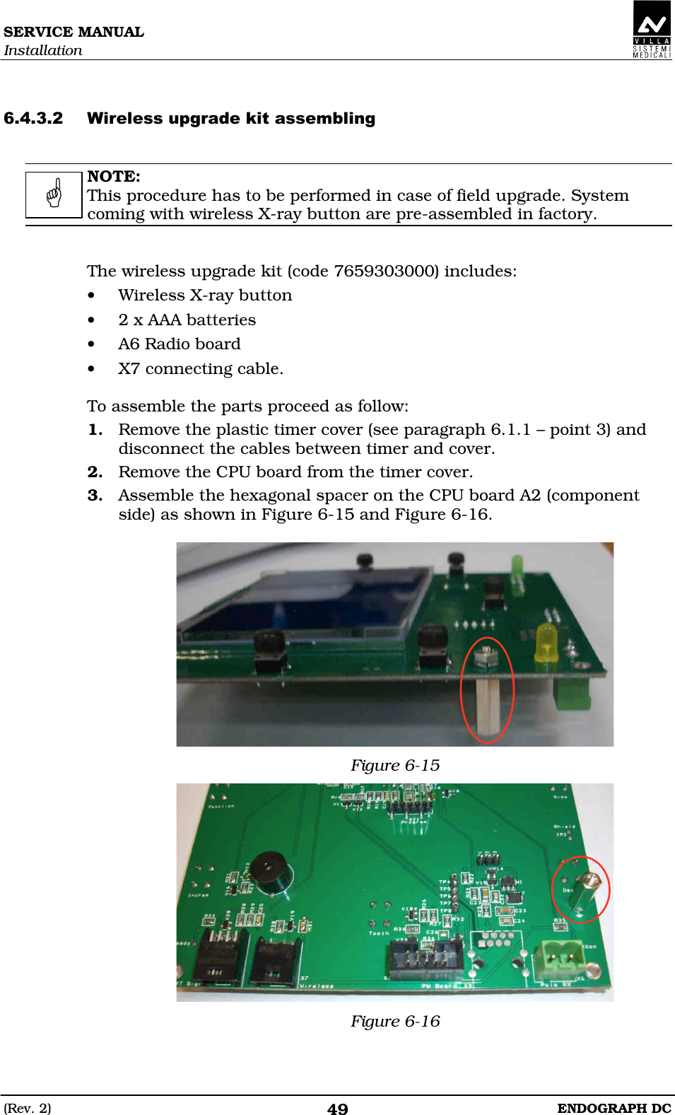 SERVICE MANUAL Installation (Rev. 2)  ENDOGRAPH DC 49   EDDEDD  NOTE: This procedure has to be performed in case of field upgrade. System coming with wireless X-ray button are pre-assembled in factory.   The wireless upgrade kit (code 7659303000) includes: • Wireless X-ray button • 2 x AAA batteries • A6 Radio board • X7 connecting cable.  To assemble the parts proceed as follow: 1. Remove the plastic timer cover (see paragraph 6.1.1 – point 3) and disconnect the cables between timer and cover. 2. Remove the CPU board from the timer cover. 3. Assemble the hexagonal spacer on the CPU board A2 (component side) as shown in Figure 6-15 and Figure 6-16.   Figure 6-15  Figure 6-16  