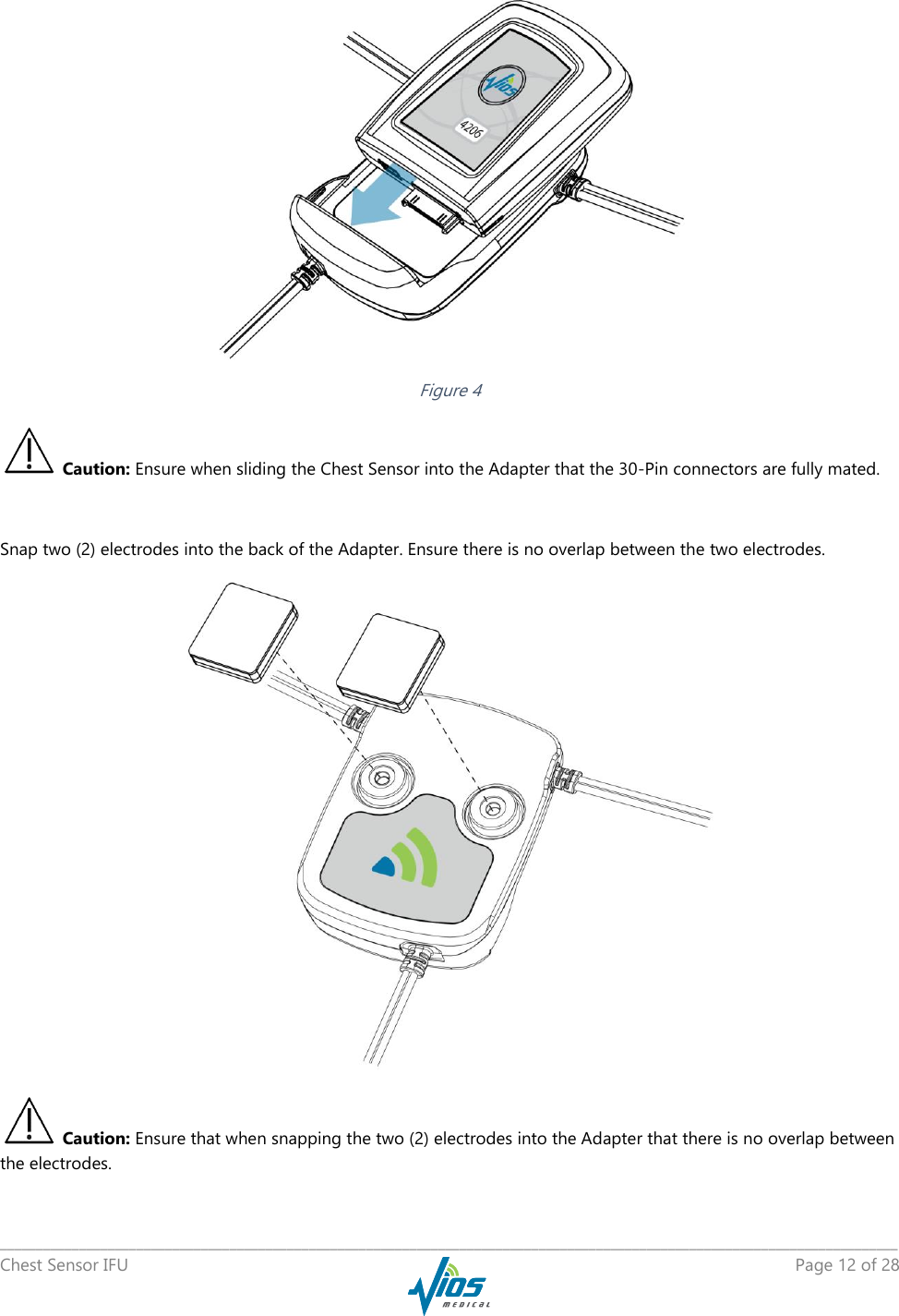   _____________________________________________________________________________________________________________________________ Chest Sensor IFU    Page 12 of 28   Figure 4  Caution: Ensure when sliding the Chest Sensor into the Adapter that the 30-Pin connectors are fully mated.  Snap two (2) electrodes into the back of the Adapter. Ensure there is no overlap between the two electrodes.    Caution: Ensure that when snapping the two (2) electrodes into the Adapter that there is no overlap between the electrodes. 