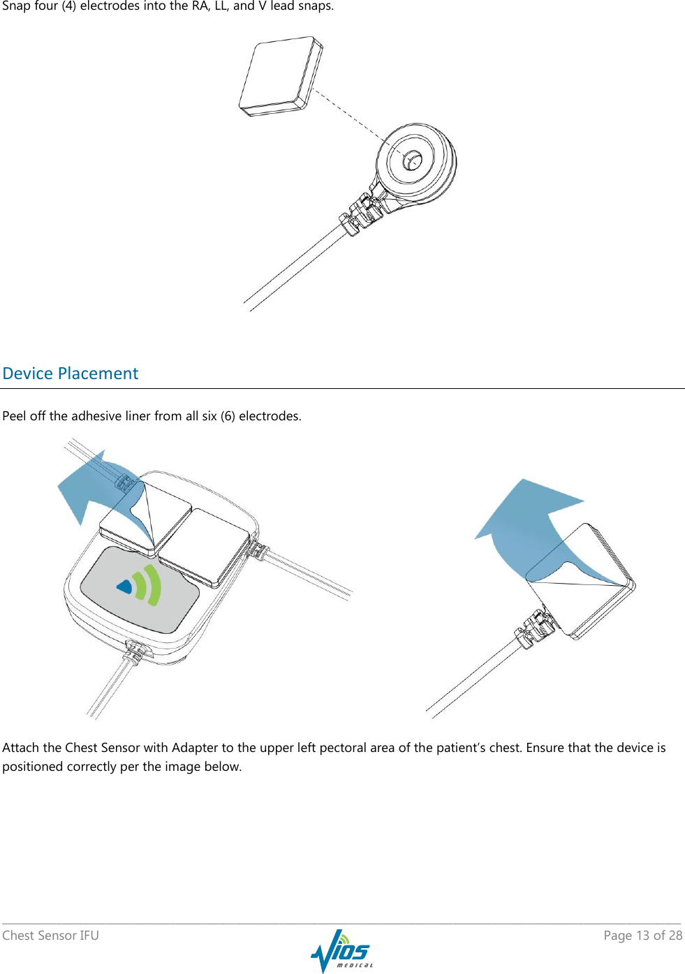   _____________________________________________________________________________________________________________________________ Chest Sensor IFU    Page 13 of 28   Snap four (4) electrodes into the RA, LL, and V lead snaps.   Device Placement Peel off the adhesive liner from all six (6) electrodes.     Attach the Chest Sensor with Adapter to the upper left pectoral area of the patient’s chest. Ensure that the device is positioned correctly per the image below. 