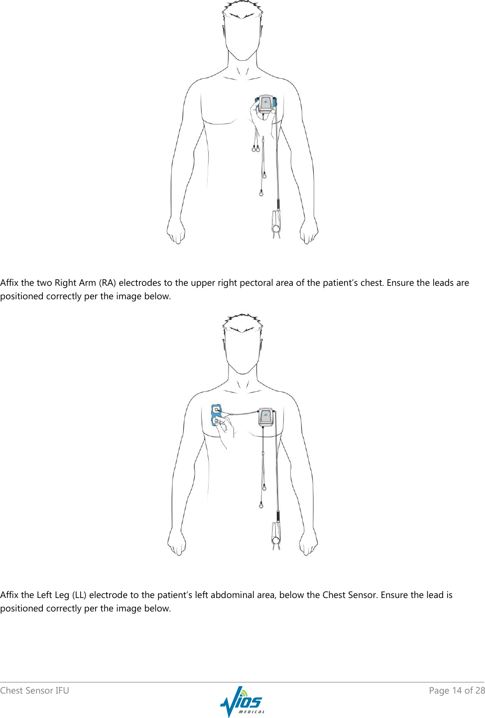   _____________________________________________________________________________________________________________________________ Chest Sensor IFU    Page 14 of 28    Affix the two Right Arm (RA) electrodes to the upper right pectoral area of the patient’s chest. Ensure the leads are positioned correctly per the image below.   Affix the Left Leg (LL) electrode to the patient’s left abdominal area, below the Chest Sensor. Ensure the lead is positioned correctly per the image below. 