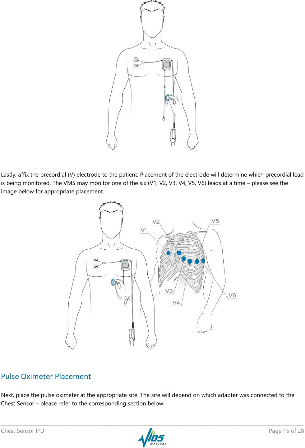   _____________________________________________________________________________________________________________________________ Chest Sensor IFU    Page 15 of 28    Lastly, affix the precordial (V) electrode to the patient. Placement of the electrode will determine which precordial lead is being monitored. The VMS may monitor one of the six (V1, V2, V3, V4, V5, V6) leads at a time – please see the image below for appropriate placement.   Pulse Oximeter Placement Next, place the pulse oximeter at the appropriate site. The site will depend on which adapter was connected to the Chest Sensor – please refer to the corresponding section below: 