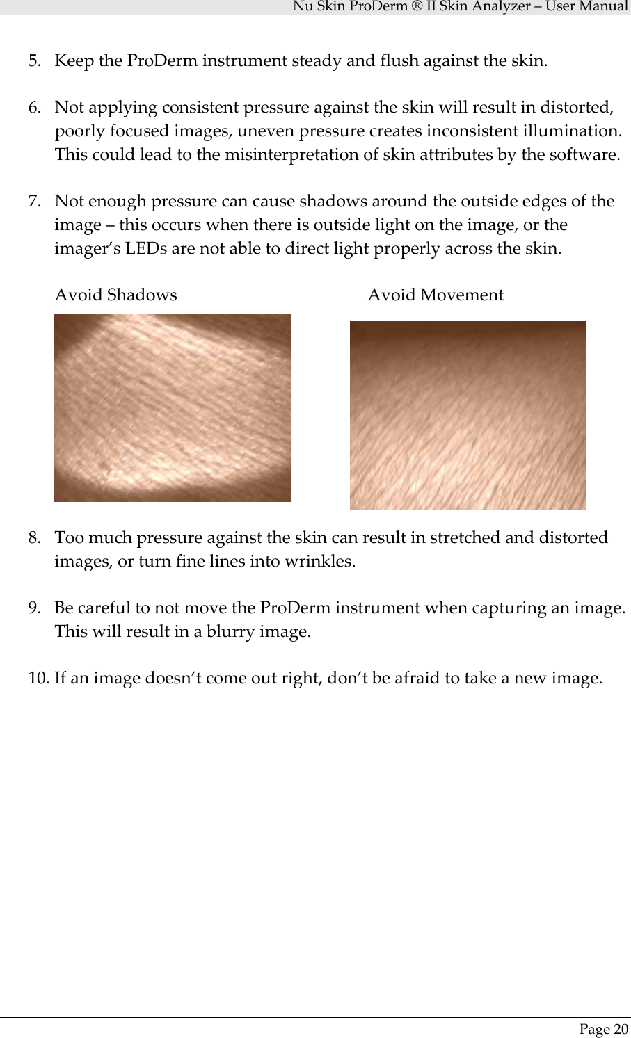 NuSkinProDerm®IISkinAnalyzer–UserManualPage205. KeeptheProDerminstrumentsteadyandflushagainsttheskin.6. Notapplyingconsistentpressureagainsttheskinwillresultindistorted,poorlyfocusedimages,unevenpressurecreatesinconsistentillumination.Thiscouldleadtothemisinterpretationofskinattributesbythesoftware.7. Notenoughpressurecancauseshadowsaroundtheoutsideedgesoftheimage–thisoccurswhenthereisoutsidelightontheimage,ortheimager’sLEDsarenotabletodirectlightproperlyacrosstheskin.AvoidShadowsAvoidMovement8. Toomuchpressureagainsttheskincanresultinstretchedanddistortedimages,orturnfinelinesintowrinkles.9. BecarefultonotmovetheProDerminstrumentwhencapturinganimage.Thiswillresultinablurryimage.10. Ifanimagedoesn’tcomeoutright,don’tbeafraidtotakeanewimage.