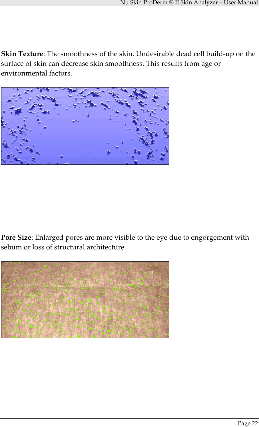 NuSkinProDerm®IISkinAnalyzer–UserManualPage22SkinTexture:Thesmoothnessoftheskin.Undesirabledeadcellbuild‐uponthesurfaceofskincandecreaseskinsmoothness.Thisresultsfromageorenvironmentalfactors.PoreSize:Enlargedporesaremorevisibletotheeyeduetoengorgementwithsebumorlossofstructuralarchitecture.