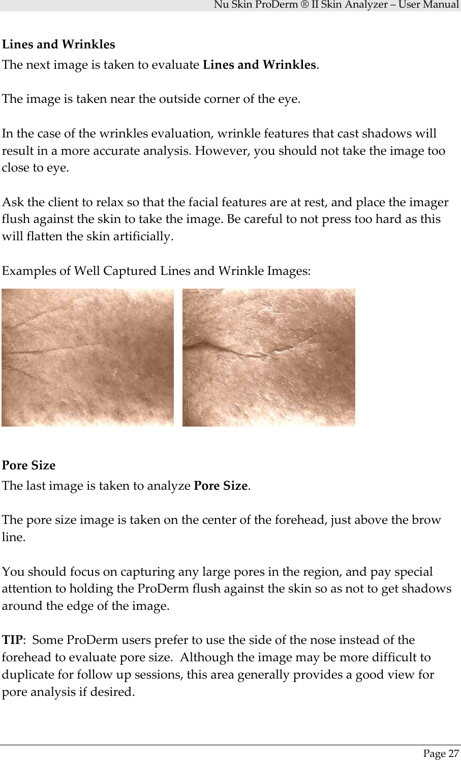 NuSkinProDerm®IISkinAnalyzer–UserManualPage27LinesandWrinklesThenextimageistakentoevaluateLinesandWrinkles.Theimageistakenneartheoutsidecorneroftheeye.Inthecaseofthewrinklesevaluation,wrinklefeaturesthatcastshadowswillresultinamoreaccurateanalysis.However,youshouldnottaketheimagetooclosetoeye.Asktheclienttorelaxsothatthefacialfeaturesareatrest,andplacetheimagerflushagainsttheskintotaketheimage.Becarefultonotpresstoohardasthiswillflattentheskinartificially.ExamplesofWellCapturedLinesandWrinkleImages:PoreSizeThelastimageistakentoanalyzePoreSize.Theporesizeimageistakenonthecenteroftheforehead,justabovethebrowline.Youshouldfocusoncapturinganylargeporesintheregion,andpayspecialattentiontoholdingtheProDermflushagainsttheskinsoasnottogetshadowsaroundtheedgeoftheimage.TIP:SomeProDermusersprefertousethesideofthenoseinsteadoftheforeheadtoevaluateporesize.Althoughtheimagemaybemoredifficulttoduplicateforfollowupsessions,thisareagenerallyprovidesagoodviewforporeanalysisifdesired.