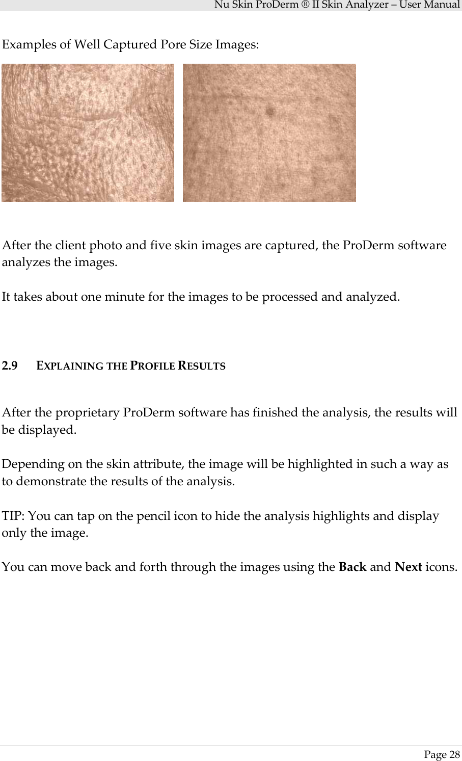 NuSkinProDerm®IISkinAnalyzer–UserManualPage28ExamplesofWellCapturedPoreSizeImages:Aftertheclientphotoandfiveskinimagesarecaptured,theProDermsoftwareanalyzestheimages.Ittakesaboutoneminutefortheimagestobeprocessedandanalyzed.2.9 EXPLAININGTHEPROFILERESULTSAftertheproprietaryProDermsoftwarehasfinishedtheanalysis,theresultswillbedisplayed.Dependingontheskinattribute,theimagewillbehighlightedinsuchawayastodemonstratetheresultsoftheanalysis.TIP:Youcantaponthepencilicontohidetheanalysishighlightsanddisplayonlytheimage.YoucanmovebackandforththroughtheimagesusingtheBackandNexticons.