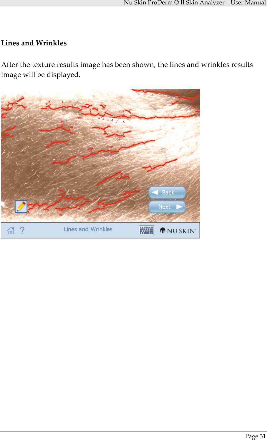 NuSkinProDerm®IISkinAnalyzer–UserManualPage31LinesandWrinklesAfterthetextureresultsimagehasbeenshown,thelinesandwrinklesresultsimagewillbedisplayed.