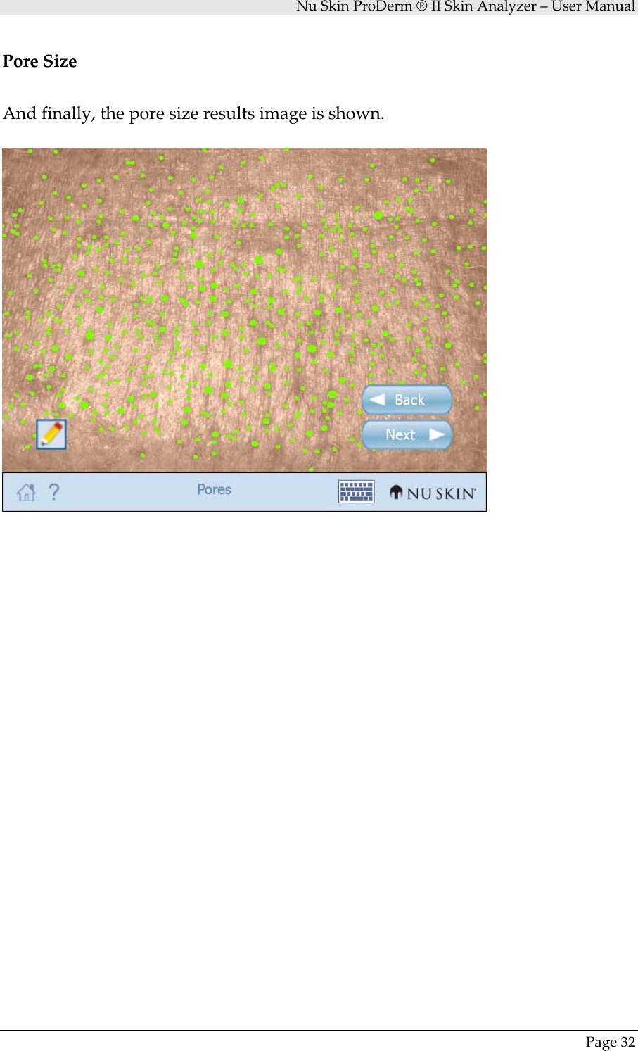 NuSkinProDerm®IISkinAnalyzer–UserManualPage32PoreSizeAndfinally,theporesizeresultsimageisshown.