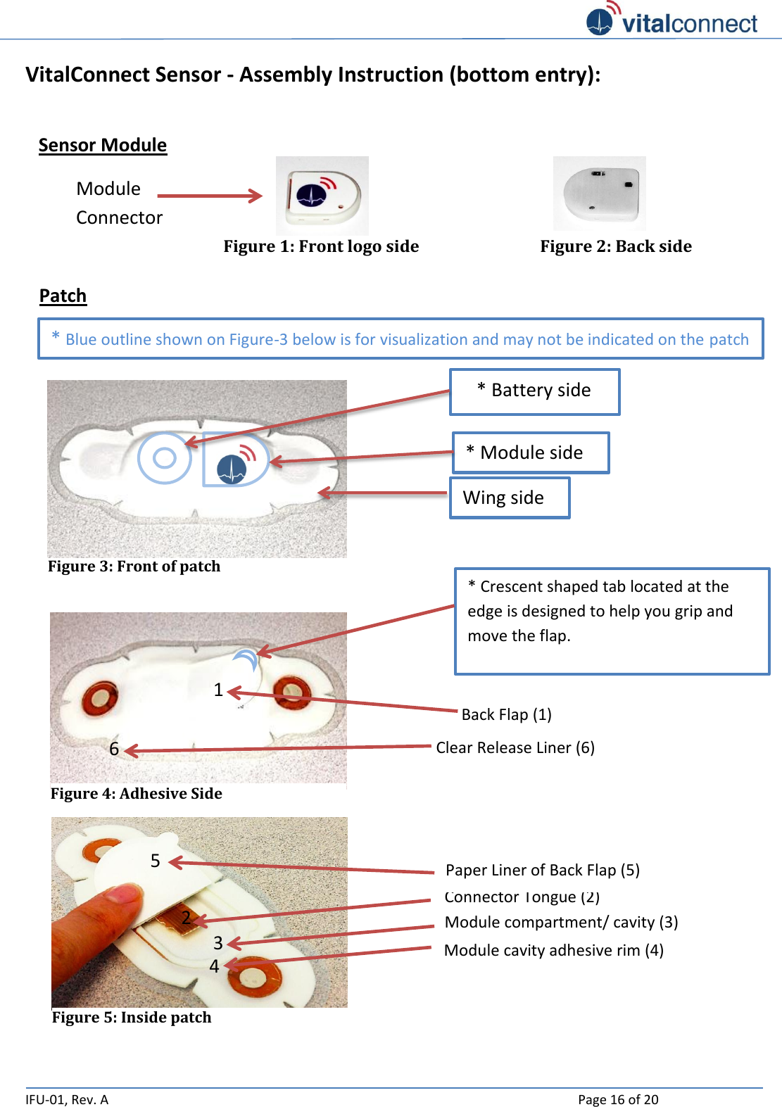   IFU-01, Rev. A    Page 16 of 20  VitalConnect Sensor - Assembly Instruction (bottom entry):  Sensor Module                                                           Patch                     Module Connector Figure 1: Front logo side Figure 2: Back side Connector Tongue (2) Module compartment/ cavity (3)  Figure 5: Inside patch Paper Liner of Back Flap (5)  2 51 3 Figure 4: Adhesive Side Back Flap (1) Clear Release Liner (6)  1 6 * Crescent shaped tab located at the edge is designed to help you grip and move the flap.  Figure 3: Front of patch    * Battery side  * Module side * Blue outline shown on Figure-3 below is for visualization and may not be indicated on the patch Wing side  4 Module cavity adhesive rim (4) 