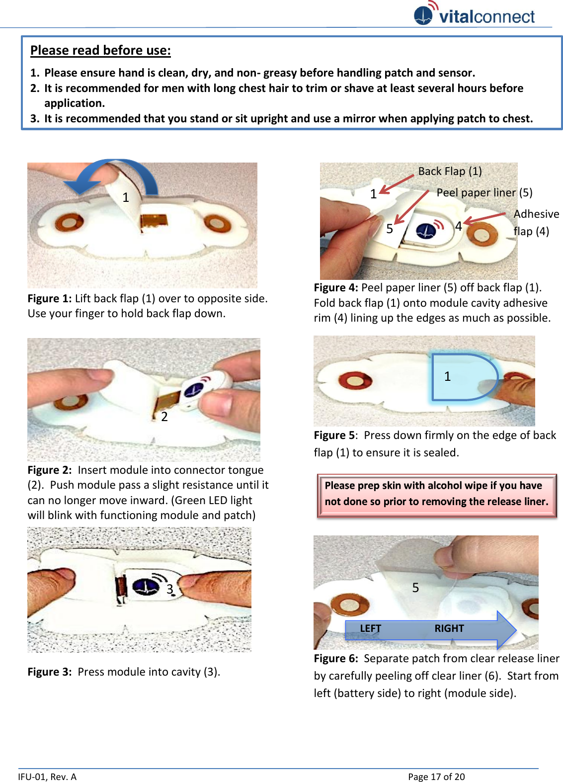   IFU-01, Rev. A    Page 17 of 20        Figure 1: Lift back flap (1) over to opposite side.  Use your finger to hold back flap down.  Figure 2:  Insert module into connector tongue (2).  Push module pass a slight resistance until it can no longer move inward. (Green LED light will blink with functioning module and patch) 2 Figure 3:  Press module into cavity (3). 1 3      Figure 4: Peel paper liner (5) off back flap (1).  Fold back flap (1) onto module cavity adhesive rim (4) lining up the edges as much as possible. Figure 5:  Press down firmly on the edge of back flap (1) to ensure it is sealed.  Figure 6:  Separate patch from clear release liner by carefully peeling off clear liner (6).  Start from left (battery side) to right (module side).   LEFT RIGHT 1 Please read before use: 1. Please ensure hand is clean, dry, and non- greasy before handling patch and sensor. 2. It is recommended for men with long chest hair to trim or shave at least several hours before application. 3. It is recommended that you stand or sit upright and use a mirror when applying patch to chest. 1 5 4 Peel paper liner (5)  Back Flap (1)  Adhesive flap (4) 5 