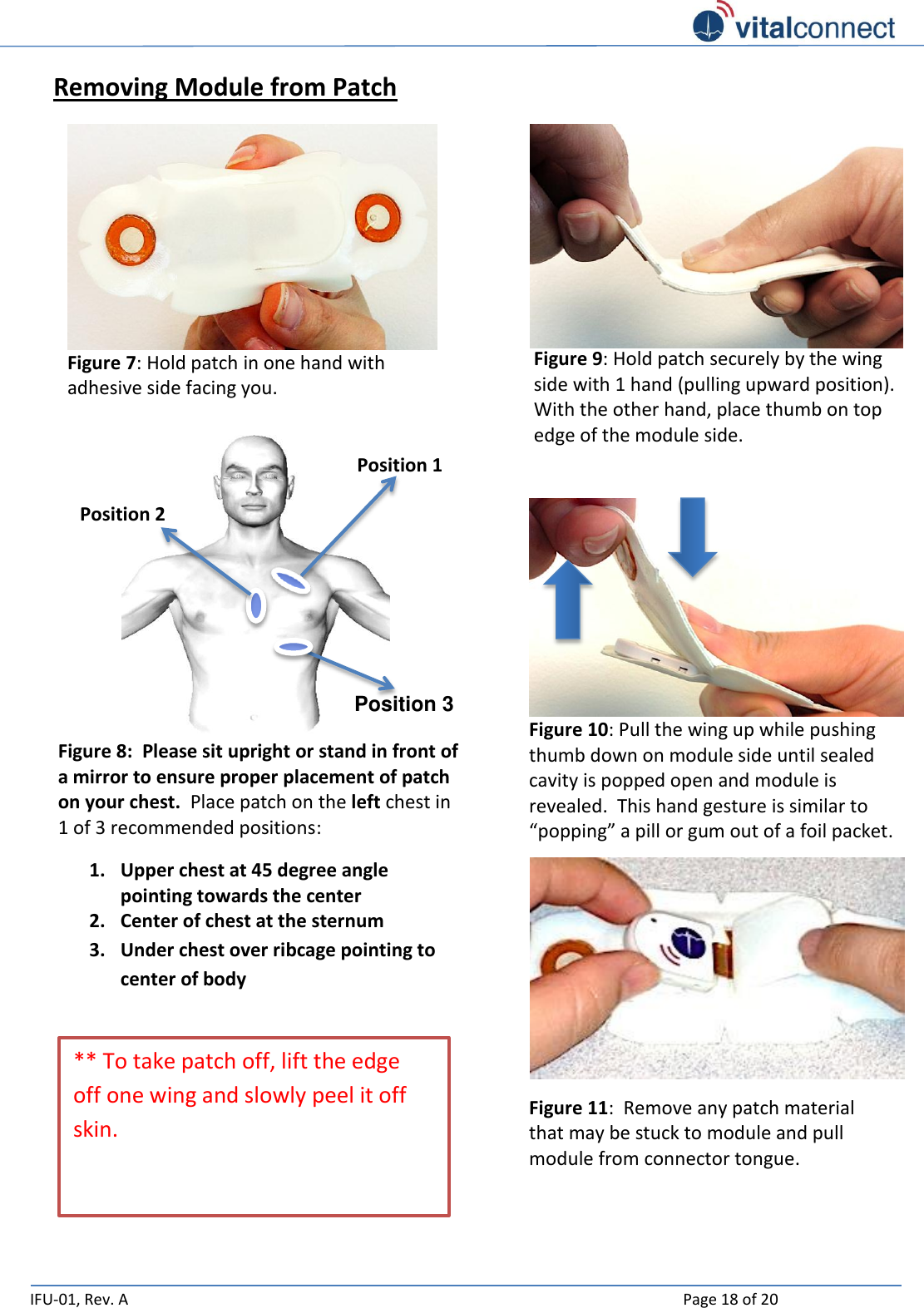   IFU-01, Rev. A    Page 18 of 20  Removing Module from Patch                             Figure 11:  Remove any patch material that may be stuck to module and pull module from connector tongue.  Figure 10: Pull the wing up while pushing thumb down on module side until sealed cavity is popped open and module is revealed.  This hand gesture is similar to “popping” a pill or gum out of a foil packet.  Figure 9: Hold patch securely by the wing side with 1 hand (pulling upward position). With the other hand, place thumb on top edge of the module side.  ** To take patch off, lift the edge off one wing and slowly peel it off skin.  Position 2 Position 3 Position 1 Figure 8:  Please sit upright or stand in front of a mirror to ensure proper placement of patch on your chest.  Place patch on the left chest in 1 of 3 recommended positions: 1. Upper chest at 45 degree angle pointing towards the center  2. Center of chest at the sternum  3. Under chest over ribcage pointing to center of body  Figure 7: Hold patch in one hand with adhesive side facing you. 