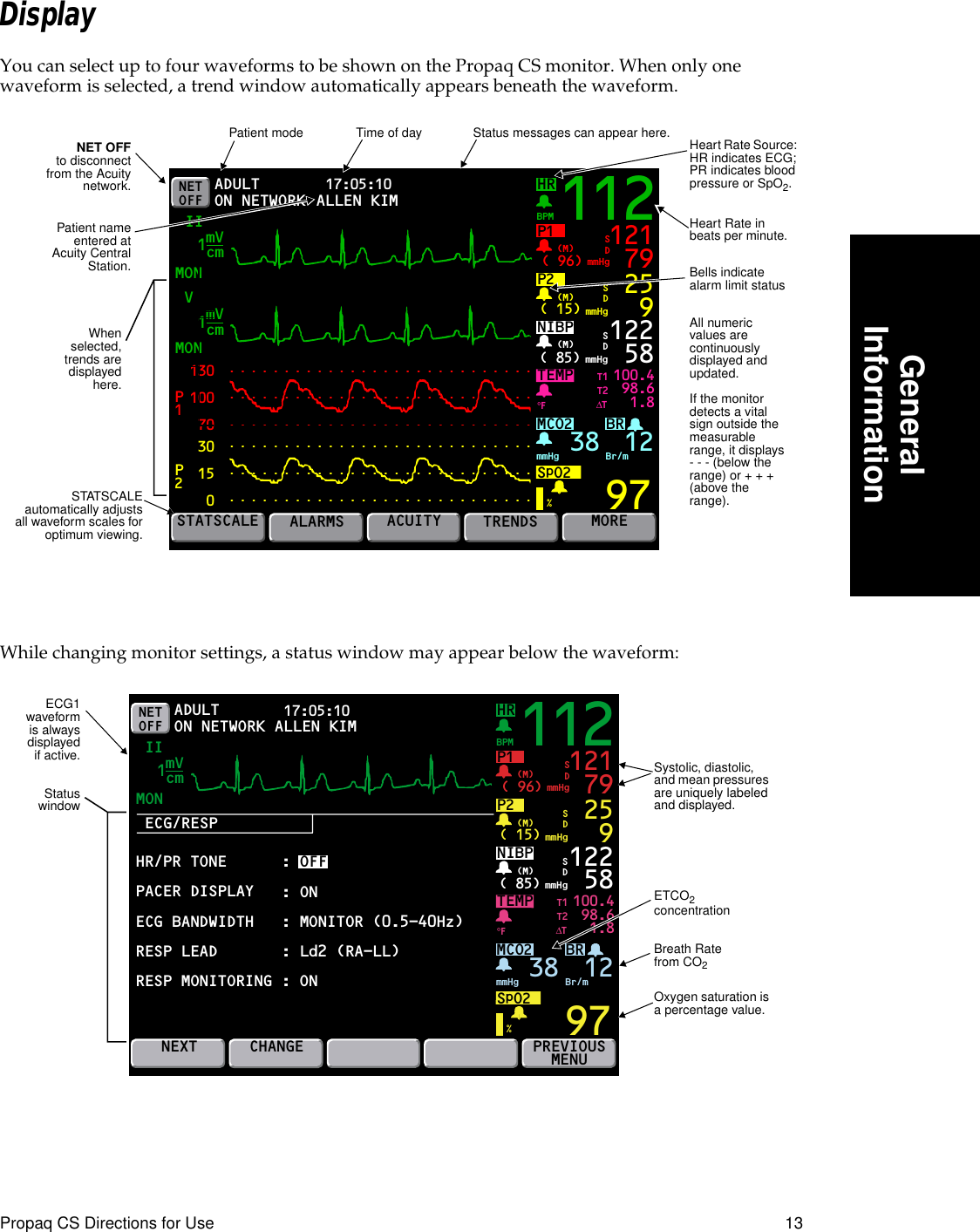  Propaq CS Directions for Use 13 GeneralInformation Display You can select up to four waveforms to be shown on the Propaq CS monitor. When only one waveform is selected, a trend window automatically appears beneath the waveform.While changing monitor settings, a status window may appear below the waveform:NET OFFHRMONVMON17:05:10 PRINT FAULT IIBRP1( 96)BPMmmHg(M)TEMP1301007030150P2P1100.498.61.897121 79SDP2( 15) mmHg(M) 259SDNIBP( 85) mmHg(M)%°F122 58MCO2SpO2mmHg 38 Br/m12SDSTATSCALEALARMSACUITYTRENDSMOREADULTON NETWORKT1T2∆TmVcm1mVcm1112ALLEN KIMBells indicate alarm limit statusNET OFFto disconnectfrom the Acuitynetwork.Heart Rate in beats per minute.Heart Rate Source: HR indicates ECG;PR indicates blood pressure or SpO2.All numeric values are continuously displayed and updated.If the monitor detects a vital sign outside the measurable range, it displays - - - (below the range) or + + + (above the range).Whenselected,trends aredisplayedhere.Patient mode Status messages can appear here.Time of dayPatient nameentered atAcuity CentralStation.STATSCALEautomatically adjustsall waveform scales foroptimum viewing.12ADULTECG/RESPMON17:05:10 PRINT FAULT IIBRP1( 96) mmHg(M)TEMP 100.498.61.897121 79SDP2( 15) mmHg(M) 259SDNIBP( 85) mmHg(M)%°F122 58MCO2SpO2mmHg 38 Br/mSDNEXTCHANGEPREVIOUSMENUNETOFF ON NETWORKT1T2∆TmVcm1112HRBPM: ON: MONITOR (0.5-40Hz): Ld2 (RA-LL): OFFHR/PR TONEPACER DISPLAYECG BANDWIDTHRESP LEADRESP MONITORING : ONALLEN KIMStatuswindowOxygen saturation is a percentage value.ETCO2 concentrationBreath Rate from CO2Systolic, diastolic, and mean pressures are uniquely labeled and displayed.ECG1waveformis alwaysdisplayedif active.