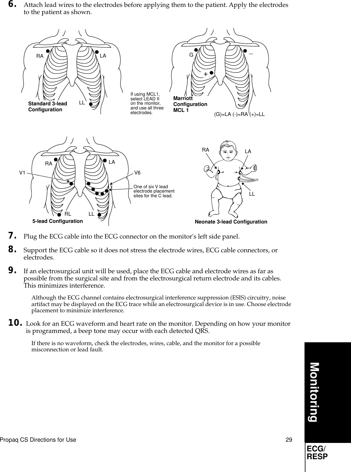 Propaq CS Directions for Use 29MonitoringECG/RESP6. Attach lead wires to the electrodes before applying them to the patient. Apply the electrodes to the patient as shown.7. Plug the ECG cable into the ECG connector on the monitor&apos;s left side panel.8. Support the ECG cable so it does not stress the electrode wires, ECG cable connectors, or electrodes.9. If an electrosurgical unit will be used, place the ECG cable and electrode wires as far as possible from the surgical site and from the electrosurgical return electrode and its cables. This minimizes interference.Although the ECG channel contains electrosurgical interference suppression (ESIS) circuitry, noise artifact may be displayed on the ECG trace while an electrosurgical device is in use. Choose electrode placement to minimize interference.10. Look for an ECG waveform and heart rate on the monitor. Depending on how your monitor is programmed, a beep tone may occur with each detected QRS.If there is no waveform, check the electrodes, wires, cable, and the monitor for a possible misconnection or lead fault.G+RA LA LL If using MCL1, select LEAD II on the monitor, and use all three electrodes.Standard 3-leadConﬁguration  (G)=LA (-)=RA (+)=LLMarriott Conﬁguration MCL 1 One of six V lead electrode placement sites for the C lead.LL LARA RL5-lead Conﬁguration V6V1Neonate 3-lead ConﬁgurationRA  LALL 