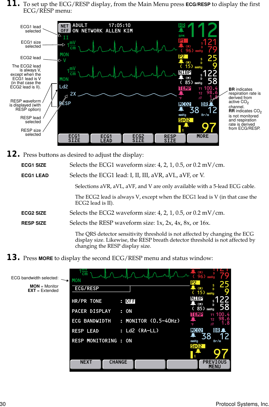 30 Protocol Systems, Inc.11. To set up the ECG/RESP display, from the Main Menu press ECG/RESP to display the first ECG/RESP menu:12. Press buttons as desired to adjust the display:ECG1 SIZE  Selects the ECG1 waveform size: 4, 2, 1, 0.5, or 0.2 mV/cm.ECG1 LEAD  Selects the ECG1 lead: I, II, III, aVR, aVL, aVF, or V.Selections aVR, aVL, aVF, and V are only available with a 5-lead ECG cable.The ECG2 lead is always V, except when the ECG1 lead is V (in that case the ECG2 lead is II).ECG2 SIZE Selects the ECG2 waveform size: 4, 2, 1, 0.5, or 0.2 mV/cm.RESP SIZE  Selects the RESP waveform size: 1x, 2x, 4x, 8x, or 16x.The QRS detector sensitivity threshold is not affected by changing the ECG display size. Likewise, the RESP breath detector threshold is not affected by changing the RESP display size.13. Press MORE to display the second ECG/RESP menu and status window:NET OFFHRMONMON17:05:10 PRINT FAULT IIBRP1( 96)BPMmmHg(M)TEMPLd2100.498.61.897121 79SDP2( 15) mmHg(M) 259SDNIBP( 85) mmHg(M)%°F122 58MCO2SpO2mmHg 38 Br/m12SDECG1SIZEECG1LEADECG2SIZERESPSIZEMOREADULTON NETWORKT1T2∆TmVcm1112RESP2XmVcm1VALLEN KIMECG1 leadselectedECG1 sizeselectedRESP waveformis displayed (withRESP option)RESP leadselectedRESP sizeselectedBR indicates respiration rate is derived from active CO2 channel. RR indicates CO2 is not monitored and respiration rate is derived from ECG/RESP.ECG2 leadThe ECG2 leadis always V,except when theECG1 lead is V(in that case theECG2 lead is II).12ECG/RESPMONBR( 96) mmHg(M)TEMP 100.498.61.897121 79SDP2( 15) mmHg(M) 259SDNIBP( 85) mmHg(M)%°F122 58MCO2SpO2mmHg 38 Br/mSDNEXTCHANGEPREVIOUSMENUT1T2∆TmVcm1: ON: MONITOR (0.5-40Hz): Ld2 (RA-LL): OFFHR/PR TONEPACER DISPLAYECG BANDWIDTHRESP LEADRESP MONITORING : ONECG bandwidth selected:MON = MonitorEXT = Extended