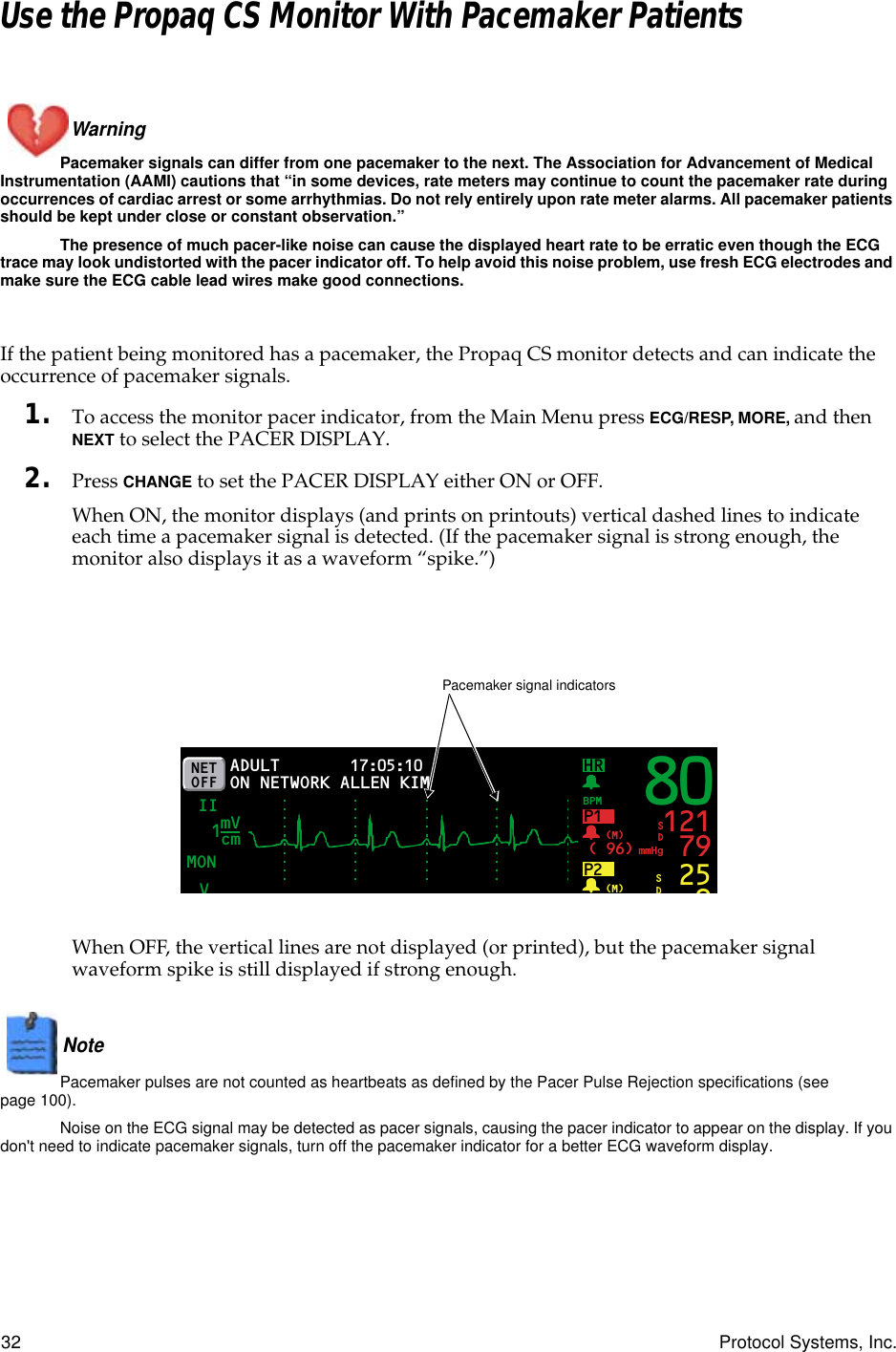 32 Protocol Systems, Inc.Use the Propaq CS Monitor With Pacemaker PatientsWarning Pacemaker signals can differ from one pacemaker to the next. The Association for Advancement of Medical Instrumentation (AAMI) cautions that “in some devices, rate meters may continue to count the pacemaker rate during occurrences of cardiac arrest or some arrhythmias. Do not rely entirely upon rate meter alarms. All pacemaker patients should be kept under close or constant observation.”The presence of much pacer-like noise can cause the displayed heart rate to be erratic even though the ECG trace may look undistorted with the pacer indicator off. To help avoid this noise problem, use fresh ECG electrodes and make sure the ECG cable lead wires make good connections.If the patient being monitored has a pacemaker, the Propaq CS monitor detects and can indicate the occurrence of pacemaker signals. 1. To access the monitor pacer indicator, from the Main Menu press ECG/RESP, MORE, and then NEXT to select the PACER DISPLAY.2. Press CHANGE to set the PACER DISPLAY either ON or OFF.When ON, the monitor displays (and prints on printouts) vertical dashed lines to indicate each time a pacemaker signal is detected. (If the pacemaker signal is strong enough, the monitor also displays it as a waveform “spike.”)When OFF, the vertical lines are not displayed (or printed), but the pacemaker signal waveform spike is still displayed if strong enough.Note  Pacemaker pulses are not counted as heartbeats as defined by the Pacer Pulse Rejection specifications (see page 100).Noise on the ECG signal may be detected as pacer signals, causing the pacer indicator to appear on the display. If you don&apos;t need to indicate pacemaker signals, turn off the pacemaker indicator for a better ECG waveform display.NET OFFHRVMON17:05:10 PRINT FAULT II P1( 96)BPMmmHg(M) 121 79SDP2(M) 259SDADULTON NETWORKmVcm1 80ALLEN KIMPacemaker signal indicators