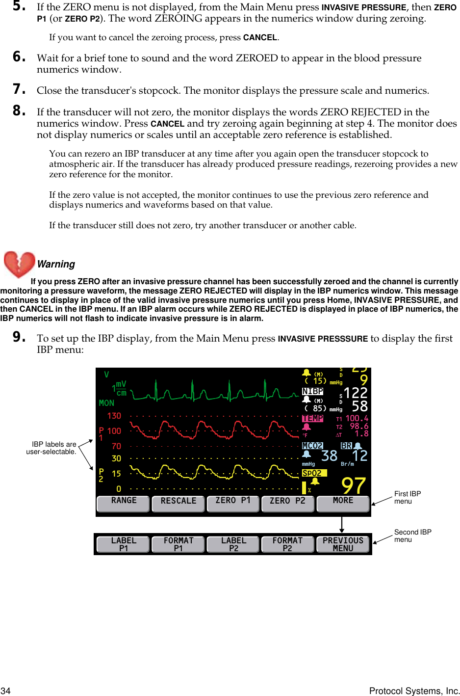34 Protocol Systems, Inc.5. If the ZERO menu is not displayed, from the Main Menu press INVASIVE PRESSURE, then ZERO P1 (or ZERO P2). The word ZEROING appears in the numerics window during zeroing.If you want to cancel the zeroing process, press CANCEL.6. Wait for a brief tone to sound and the word ZEROED to appear in the blood pressure numerics window.7. Close the transducer&apos;s stopcock. The monitor displays the pressure scale and numerics.8. If the transducer will not zero, the monitor displays the words ZERO REJECTED in the numerics window. Press CANCEL and try zeroing again beginning at step 4. The monitor does not display numerics or scales until an acceptable zero reference is established.You can rezero an IBP transducer at any time after you again open the transducer stopcock to atmospheric air. If the transducer has already produced pressure readings, rezeroing provides a new zero reference for the monitor.If the zero value is not accepted, the monitor continues to use the previous zero reference and displays numerics and waveforms based on that value.If the transducer still does not zero, try another transducer or another cable.Warning If you press ZERO after an invasive pressure channel has been successfully zeroed and the channel is currently monitoring a pressure waveform, the message ZERO REJECTED will display in the IBP numerics window. This message continues to display in place of the valid invasive pressure numerics until you press Home, INVASIVE PRESSURE, and then CANCEL in the IBP menu. If an IBP alarm occurs while ZERO REJECTED is displayed in place of IBP numerics, the IBP numerics will not flash to indicate invasive pressure is in alarm.9. To set up the IBP display, from the Main Menu press INVASIVE PRESSSURE to display the first IBP menu:MONVBRTEMP1301007030150P2P1100.498.61.897( 15) mmHg(M)259SDNIBP( 85) mmHg(M)%°F122 58MCO2SpO2mmHg 38 Br/m12SDRANGERESCALEZERO P1ZERO P2MORET1T2∆TmVcm1LABELP1FORMATP1PREVIOUSMENUFORMATP2LABELP2First IBP menuSecond IBP menuIBP labels areuser-selectable.