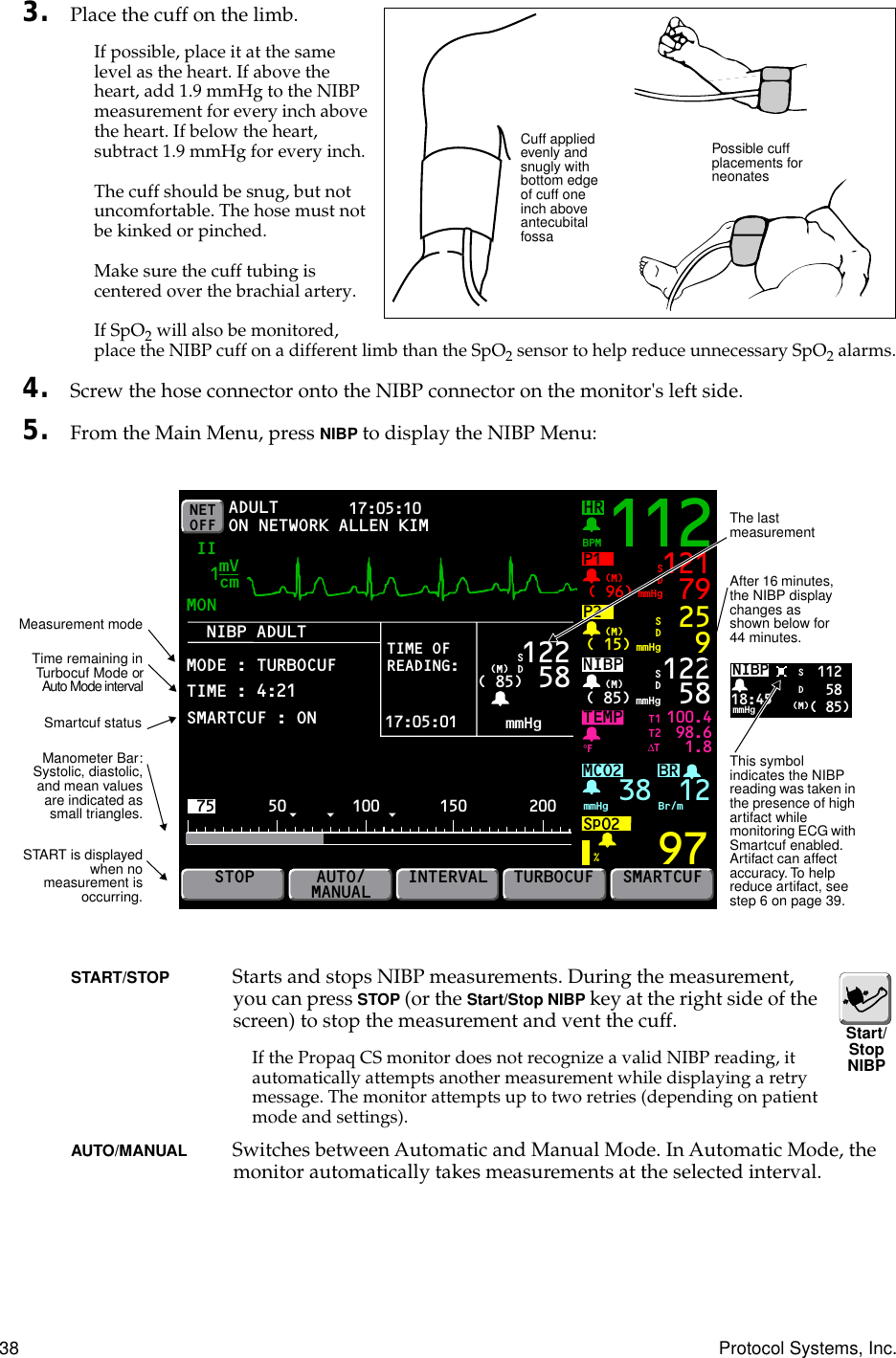 38 Protocol Systems, Inc.3. Place the cuff on the limb.If possible, place it at the same level as the heart. If above the heart, add 1.9 mmHg to the NIBP measurement for every inch above the heart. If below the heart, subtract 1.9 mmHg for every inch.The cuff should be snug, but not uncomfortable. The hose must not be kinked or pinched. Make sure the cuff tubing is centered over the brachial artery.If SpO2 will also be monitored, place the NIBP cuff on a different limb than the SpO2 sensor to help reduce unnecessary SpO2 alarms.4. Screw the hose connector onto the NIBP connector on the monitor&apos;s left side.5. From the Main Menu, press NIBP to display the NIBP Menu:START/STOP  Starts and stops NIBP measurements. During the measurement, you can press STOP (or the Start/Stop NIBP key at the right side of the screen) to stop the measurement and vent the cuff.If the Propaq CS monitor does not recognize a valid NIBP reading, it automatically attempts another measurement while displaying a retry message. The monitor attempts up to two retries (depending on patient mode and settings).AUTO/MANUAL  Switches between Automatic and Manual Mode. In Automatic Mode, the monitor automatically takes measurements at the selected interval.Cuff applied evenly and snugly with bottom edge of cuff one inch above antecubital fossaPossible cuff placements for neonates112 58 ( 85)NIBP18:45SD(M)mmHgADULTNIBP ADULTMODE : TURBOCUFTIME : 4:21SMARTCUF : ONMON17:05:10 PRINT FAULT IIBRP1( 96) mmHg(M)TEMP 100.498.61.897121 79SDP2( 15) mmHg(M) 259SDNIBP( 85) mmHg(M)%°F122 58MCO2SpO2mmHg 38 Br/mSDSTOPAUTO/MANUALINTERVAL SMARTCUFNETOFF ON NETWORKT1T2∆TmVcm1112HRBPMmmHgTURBOCUF( 85)75 50 100 150 20017:05:01TIME OFREADING: (M) 122 58SD12ALLEN KIMManometer Bar:Systolic, diastolic,and mean valuesare indicated assmall triangles.The last measurementMeasurement modeAfter 16 minutes, the NIBP display changes as shown below for 44 minutes.Time remaining inTurbocuf Mode orAuto Mode intervalSTART is displayedwhen nomeasurement isoccurring.This symbol indicates the NIBP reading was taken in the presence of high artifact while monitoring ECG with Smartcuf enabled. Artifact can affect accuracy. To help reduce artifact, see step 6 on page 39.Smartcuf statusStart/Stop NIBP