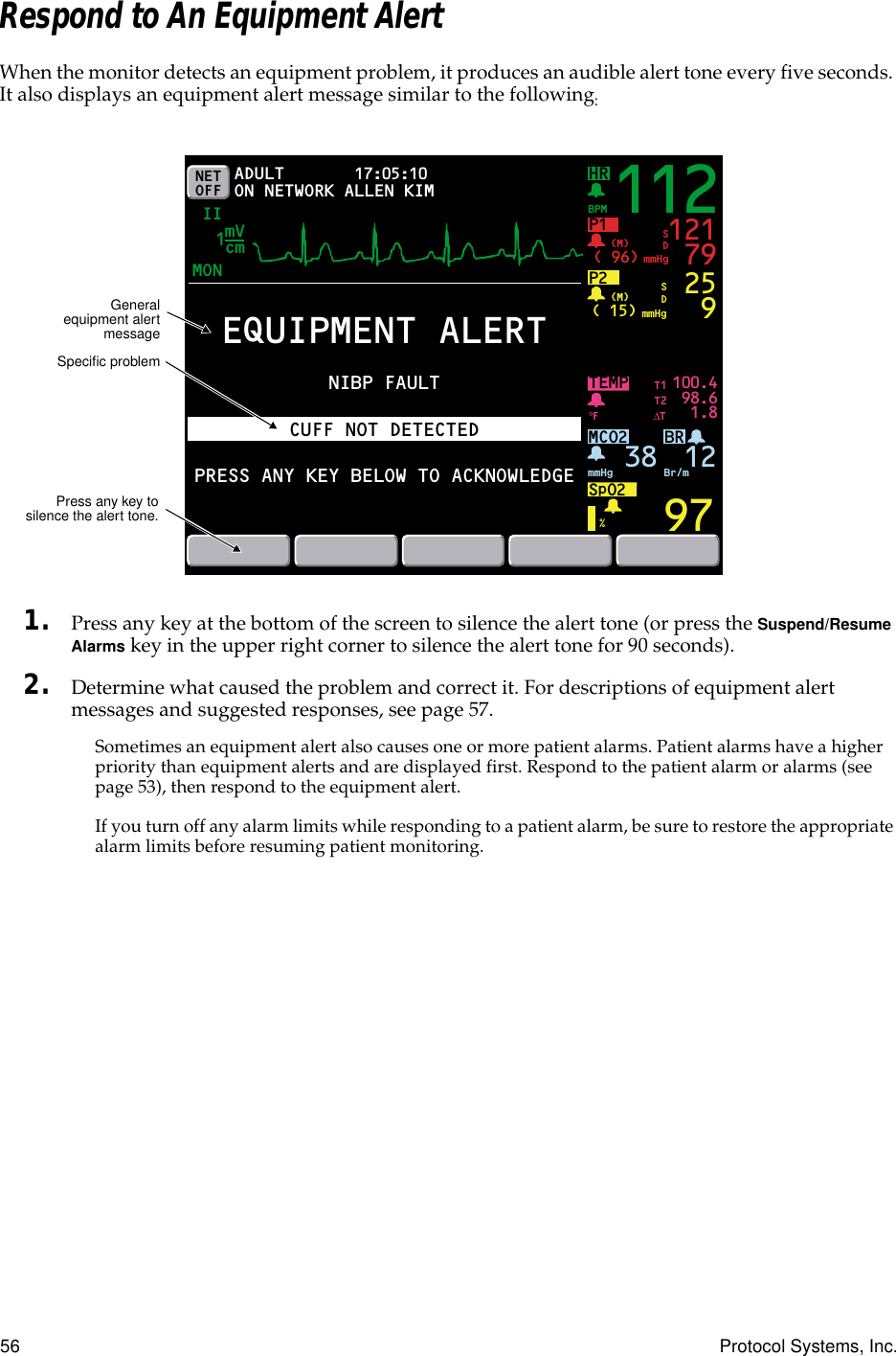 56 Protocol Systems, Inc.Respond to An Equipment AlertWhen the monitor detects an equipment problem, it produces an audible alert tone every five seconds. It also displays an equipment alert message similar to the following:1. Press any key at the bottom of the screen to silence the alert tone (or press the Suspend/Resume Alarms key in the upper right corner to silence the alert tone for 90 seconds).2. Determine what caused the problem and correct it. For descriptions of equipment alert messages and suggested responses, see page 57.Sometimes an equipment alert also causes one or more patient alarms. Patient alarms have a higher priority than equipment alerts and are displayed first. Respond to the patient alarm or alarms (see page 53), then respond to the equipment alert.If you turn off any alarm limits while responding to a patient alarm, be sure to restore the appropriate alarm limits before resuming patient monitoring.NET OFFHRMON17:05:10 PRINT FAULT IIBRP1( 96)BPMmmHg(M)TEMP 100.498.61.897121 79SDP2( 15) mmHg(M) 259SD%°FMCO2SpO2mmHg 38 Br/m12ADULTON NETWORKT1T2∆TmVcm1112EQUIPMENT ALERTNIBP FAULTCUFF NOT DETECTEDPRESS ANY KEY BELOW TO ACKNOWLEDGEALLEN KIMGeneralequipment alertmessageSpeciﬁc problemPress any key tosilence the alert tone.