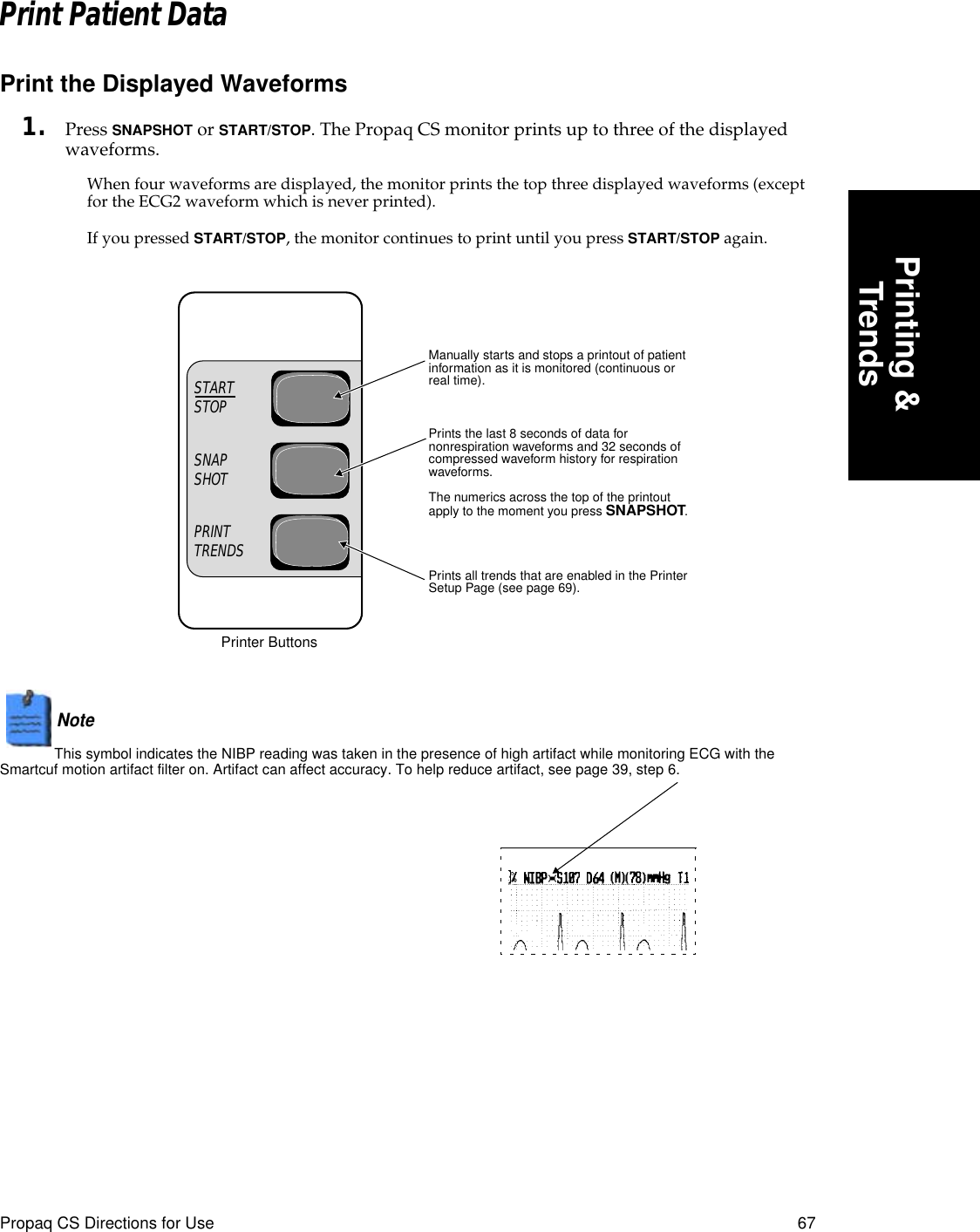 Propaq CS Directions for Use 67Printing &amp;TrendsPrint Patient DataPrint the Displayed Waveforms1. Press SNAPSHOT or START/STOP. The Propaq CS monitor prints up to three of the displayed waveforms.When four waveforms are displayed, the monitor prints the top three displayed waveforms (except for the ECG2 waveform which is never printed).If you pressed START/STOP, the monitor continues to print until you press START/STOP again.Note  This symbol indicates the NIBP reading was taken in the presence of high artifact while monitoring ECG with the Smartcuf motion artifact filter on. Artifact can affect accuracy. To help reduce artifact, see page 39, step 6.STARTSTOPSNAPSHOTPRINTTRENDSManually starts and stops a printout of patient information as it is monitored (continuous or real time).Prints all trends that are enabled in the Printer Setup Page (see page 69).Prints the last 8 seconds of data for nonrespiration waveforms and 32 seconds of compressed waveform history for respiration waveforms.The numerics across the top of the printout apply to the moment you press SNAPSHOT.Printer Buttons