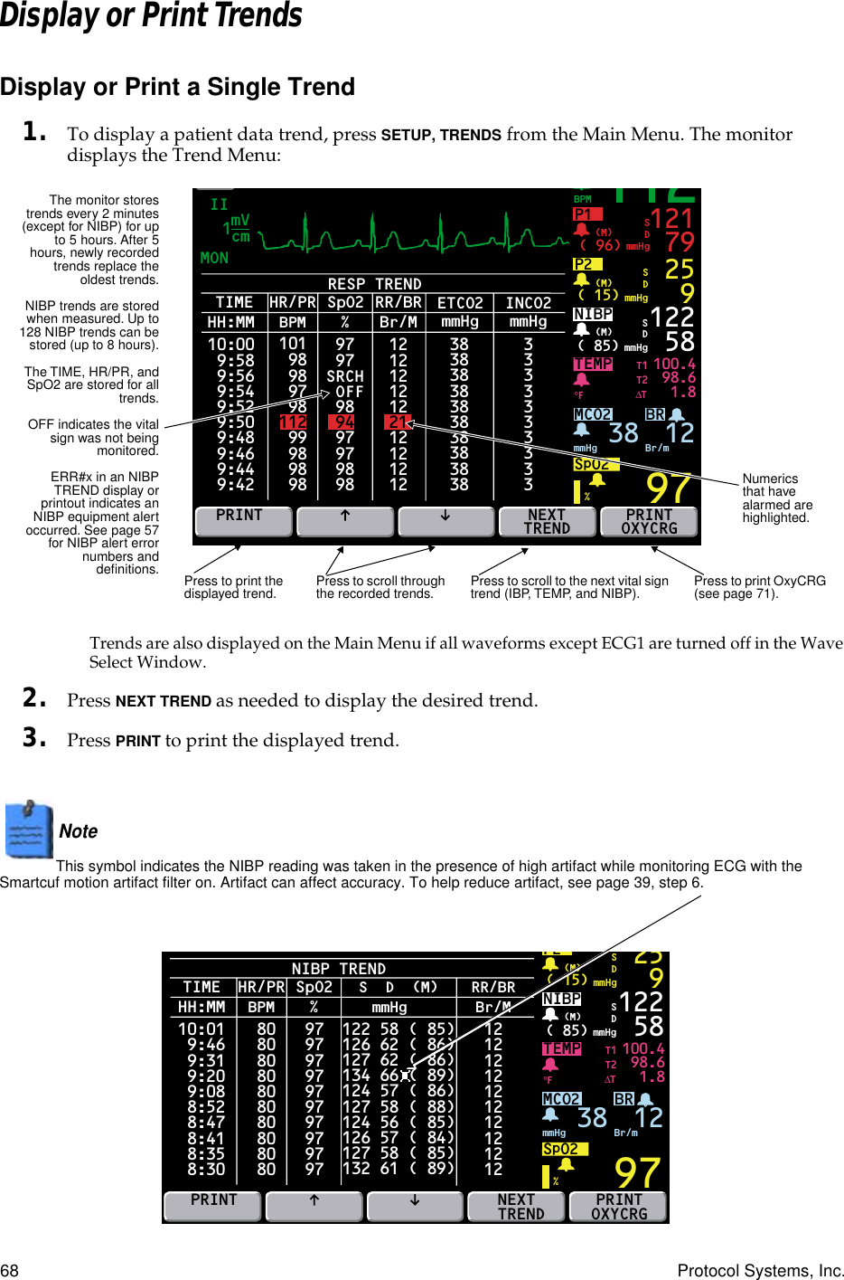 68 Protocol Systems, Inc.Display or Print TrendsDisplay or Print a Single Trend1. To display a patient data trend, press SETUP, TRENDS from the Main Menu. The monitor displays the Trend Menu:Trends are also displayed on the Main Menu if all waveforms except ECG1 are turned off in the Wave Select Window.2. Press NEXT TREND as needed to display the desired trend.3. Press PRINT to print the displayed trend.Note  This symbol indicates the NIBP reading was taken in the presence of high artifact while monitoring ECG with the Smartcuf motion artifact filter on. Artifact can affect accuracy. To help reduce artifact, see page 39, step 6.RESP TRENDTIMEMON IIBRP1( 96) mmHg(M)TEMP 100.498.61.897121 79SDP2( 15) mmHg(M) 259SDNIBP( 85) mmHg(M)%°F122 58MCO2SpO2mmHg 38 Br/mSDPRINT PRINTOXYCRGT1T2∆TmVcm1112BPM10:00 9:58 9:56 9:54 9:52 9:50 9:48 9:46 9:44 9:42HH:MMHR/PR SpO2RR/BRBPM % Br/M9898979899989898 97 9712121212122112121212SRCH OFF 98 94 97 97 98 98ETCO2INCO2mmHg38383838383838383838mmHg333333333311210112NEXTTRENDPress to scroll through the recorded trends.Press to print the displayed trend.The monitor storestrends every 2 minutes(except for NIBP) for upto 5 hours. After 5hours, newly recordedtrends replace theoldest trends.NIBP trends are storedwhen measured. Up to128 NIBP trends can bestored (up to 8 hours).The TIME, HR/PR, andSpO2 are stored for alltrends.OFF indicates the vitalsign was not beingmonitored.ERR#x in an NIBPTREND display orprintout indicates anNIBP equipment alertoccurred. See page 57for NIBP alert errornumbers anddeﬁnitions. Press to scroll to the next vital sign trend (IBP, TEMP, and NIBP). Press to print OxyCRG (see page 71).Numerics that have alarmed are highlighted.NIBP TRENDTIMEBRTEMP 100.498.61.897P2( 15) mmHg(M)259SDNIBP( 85) mmHg(M)%°F122 58MCO2SpO2mmHg 38 Br/mSDPRINTT1T2∆T10:01 9:46 9:31 9:20 9:08 8:52 8:47 8:41 8:35 8:30HH:MMHR/PR SpO2S  D  (M) RR/BRBPM % mmHg Br/M8080808080808080808097979797979797979797122 58 ( 85)126 62 ( 86)127 62 ( 86)134 66 ( 89)124 57 ( 86)127 58 ( 88)124 56 ( 85)126 57 ( 84)127 58 ( 85)132 61 ( 89)12121212121212121212PRINTOXYCRGNEXT TREND12